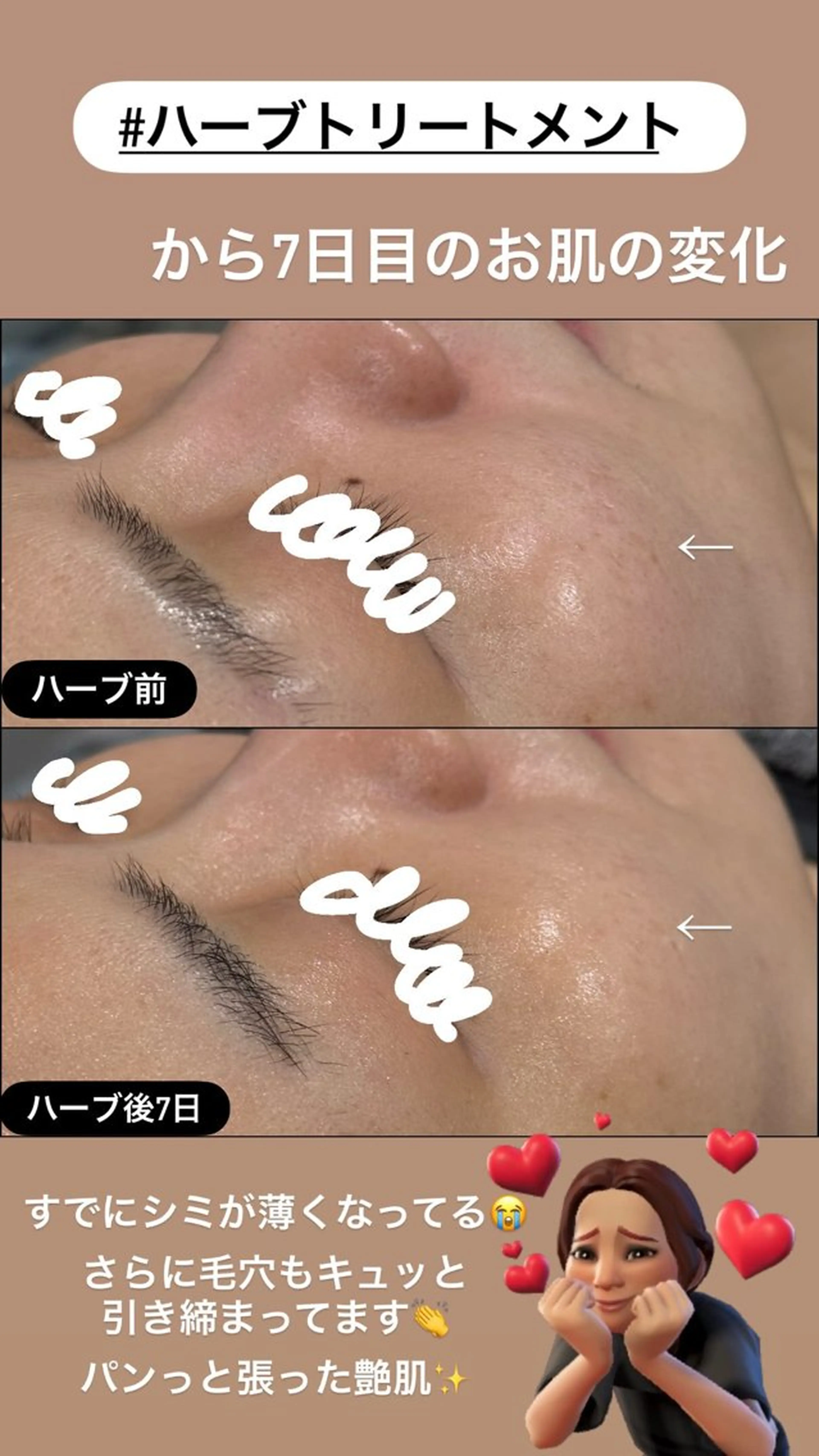 エステ LiZA エステティックサロンのエステ・リラクイメージ