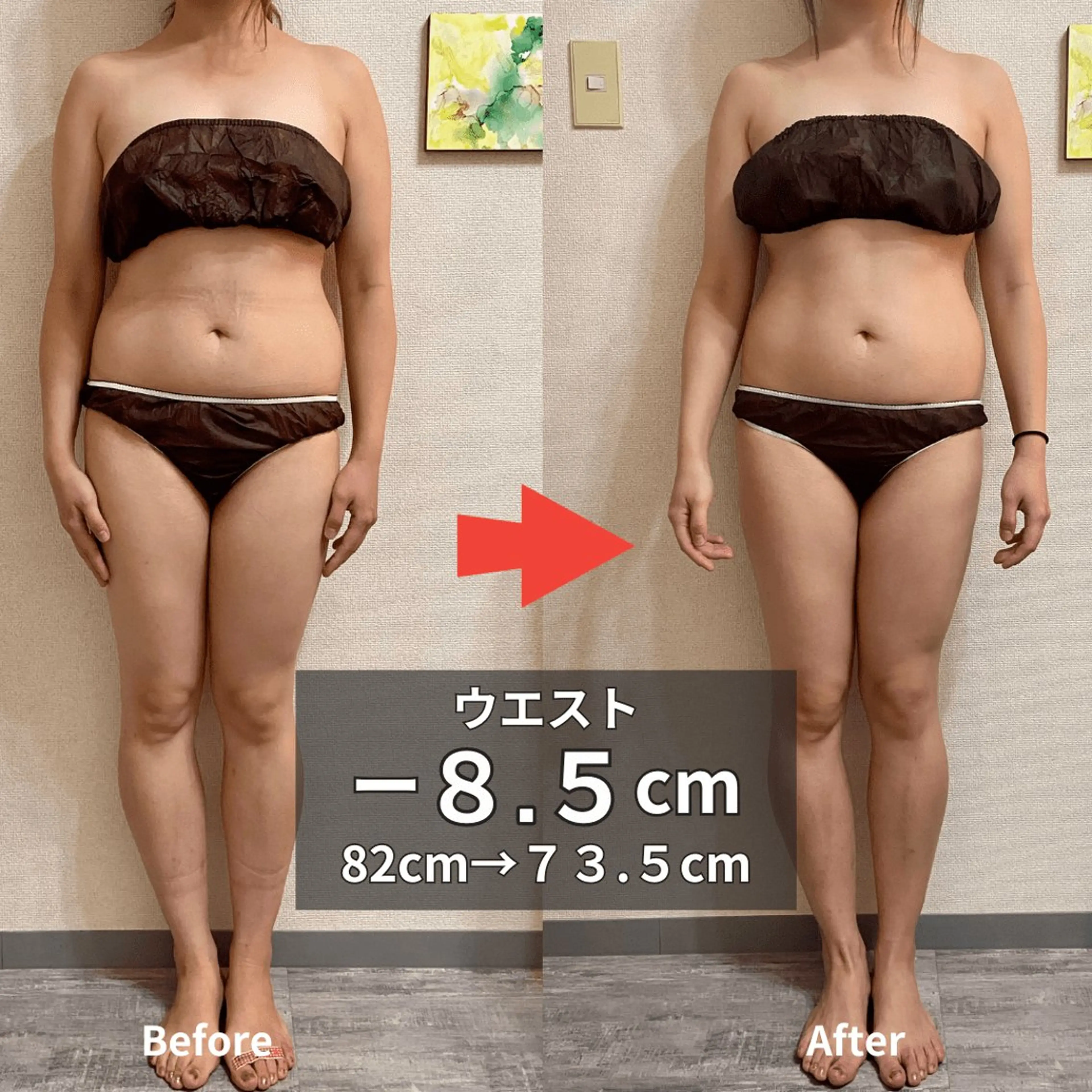 エステ リラク 骨盤矯正ダイエット ぷりんす整体COZYのエステ・リラクイメージ