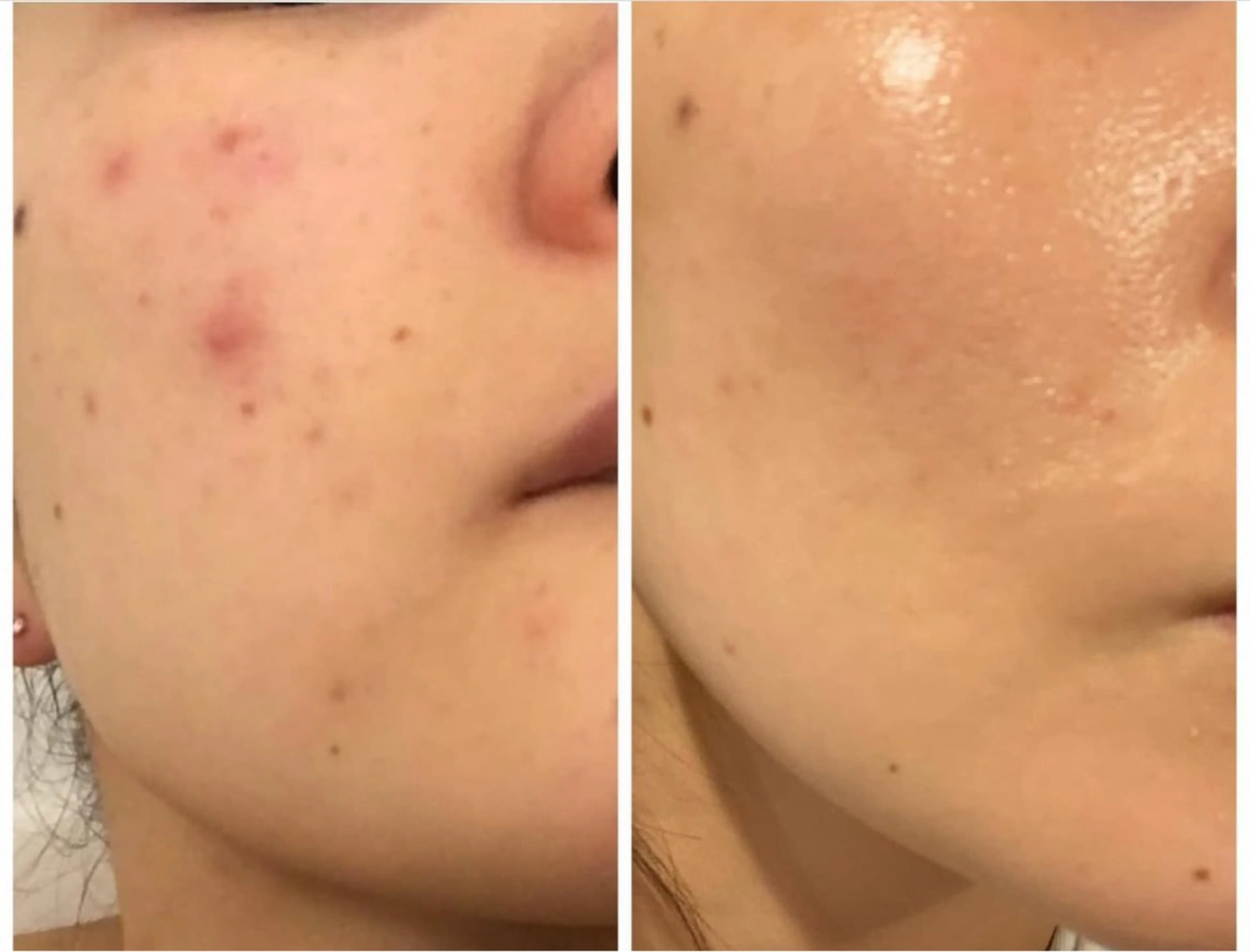 エステ 久留本 茜のエステ・リラクイメージ