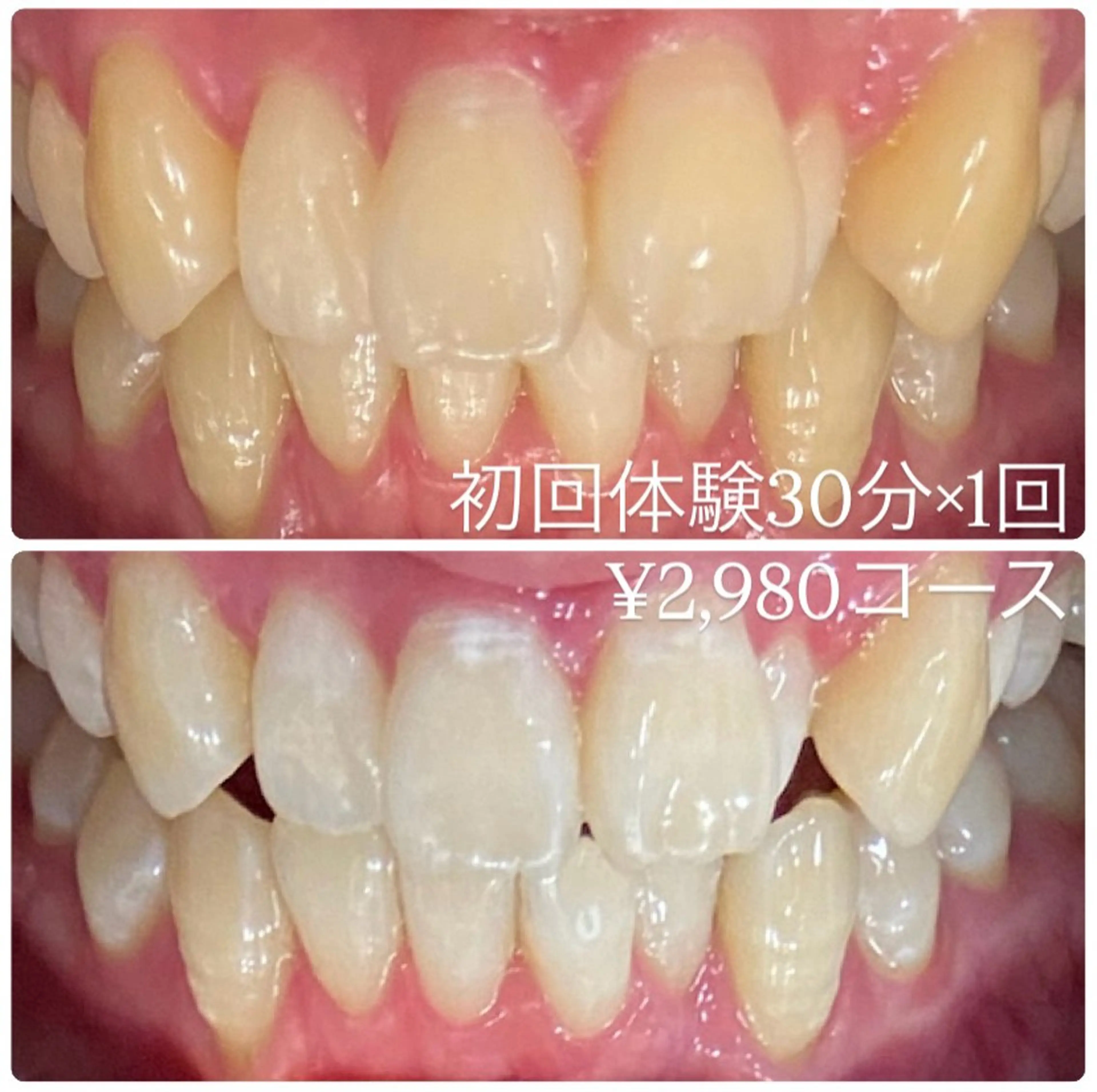 ホワイトニングルーム 横浜店のその他イメージ