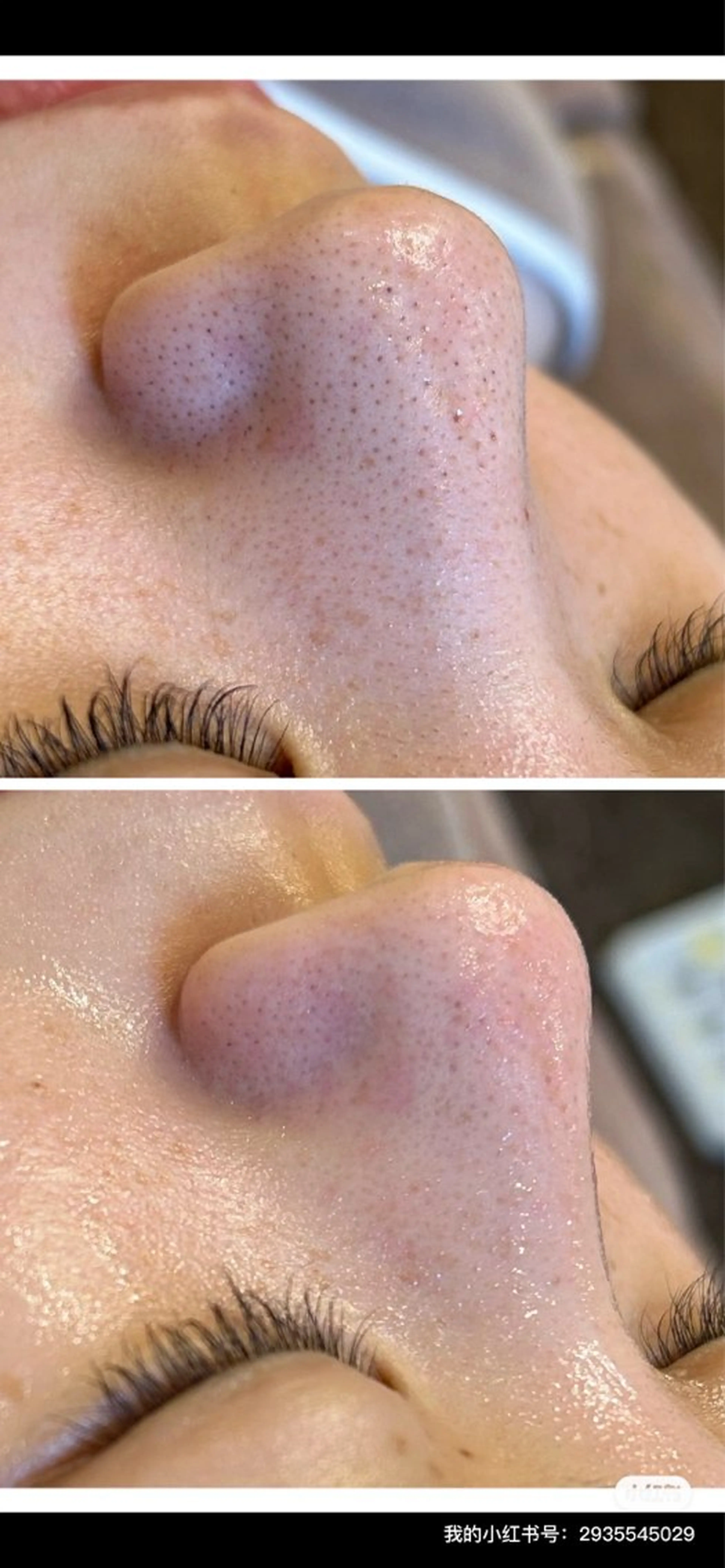 西区九条エステ MITUREIサロンのエステ・リラクイメージ