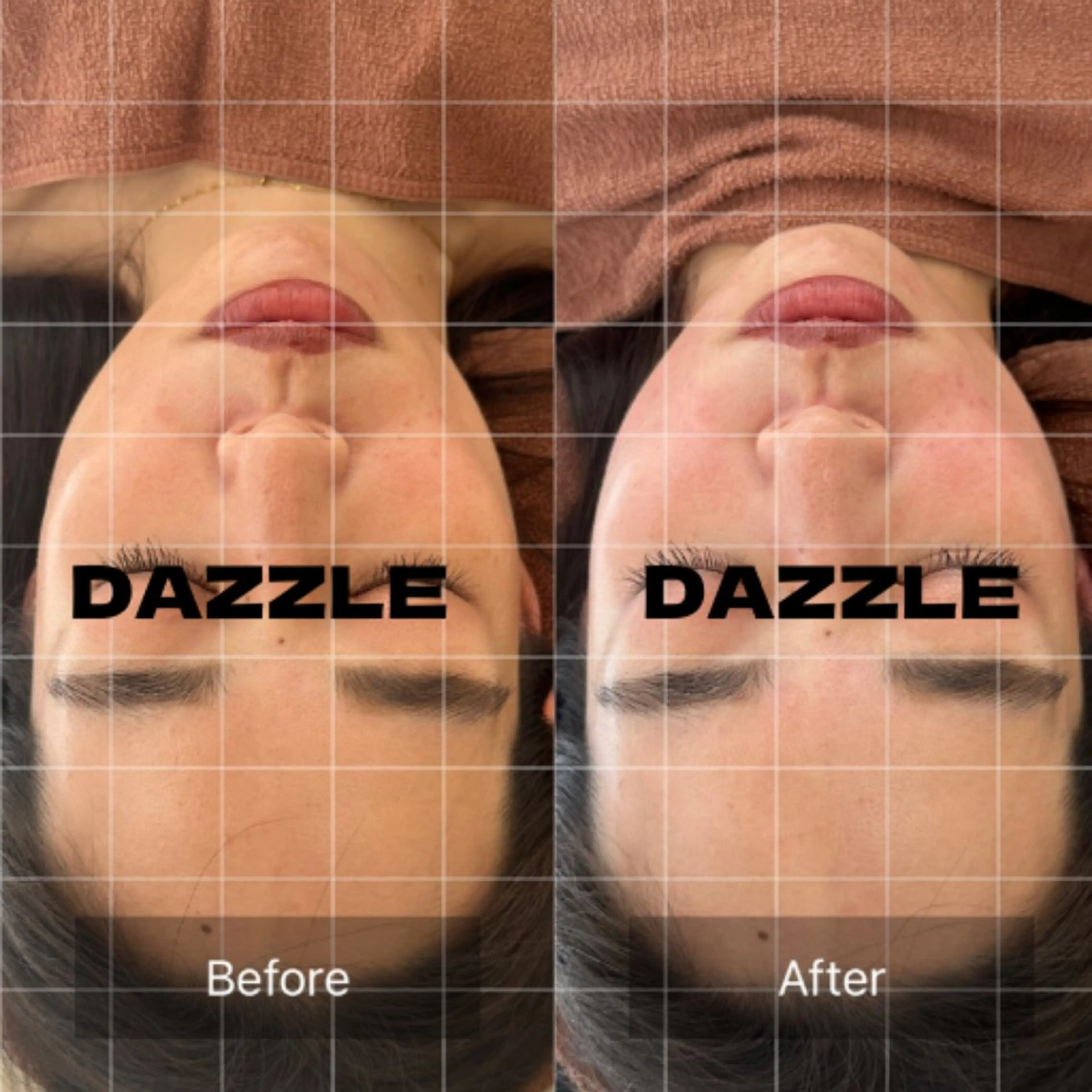 小顔・たるみ専門 DAZZLEのエステ・リラクイメージ
