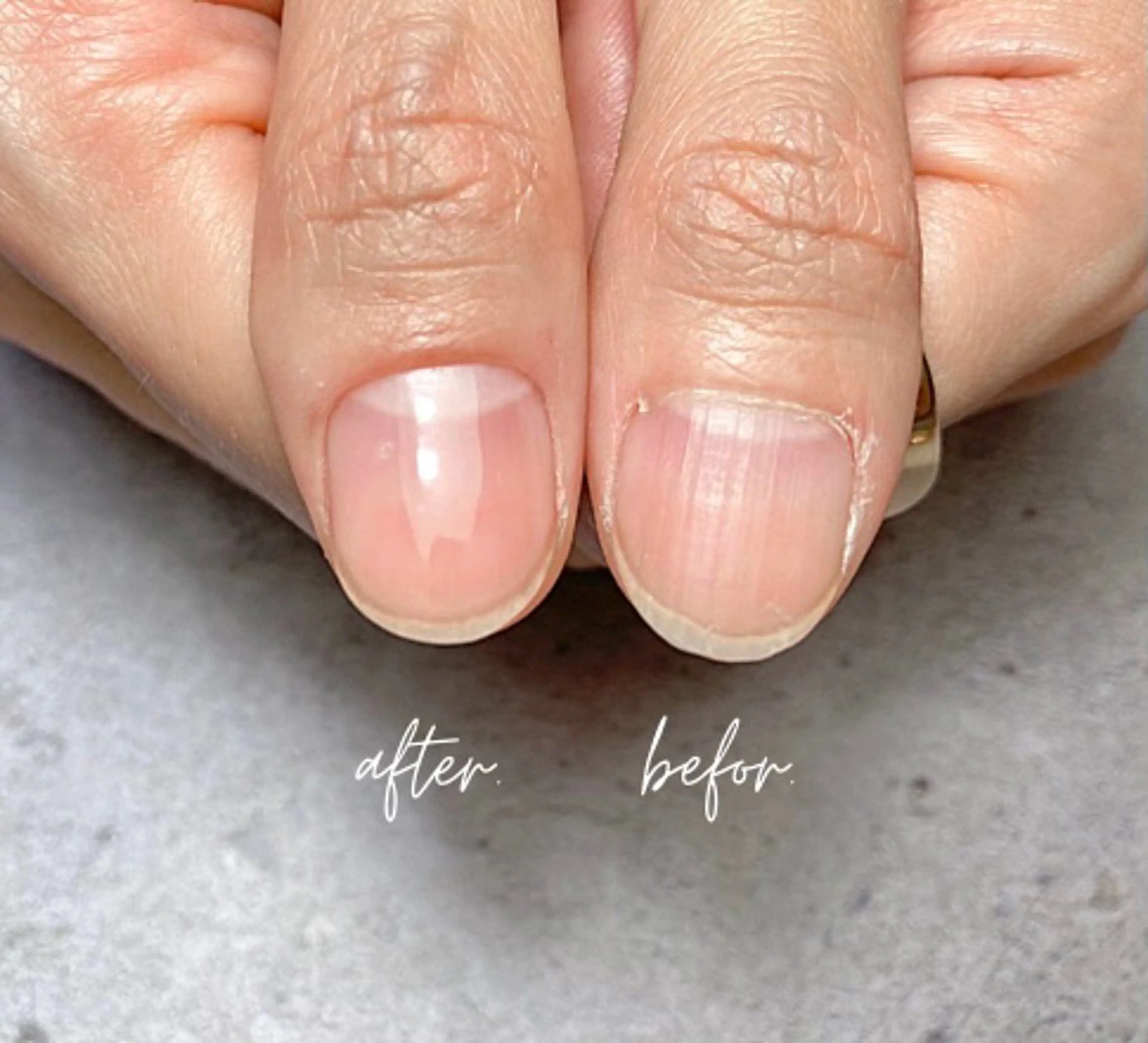 自爪をきれいにハンドケアコースの写真