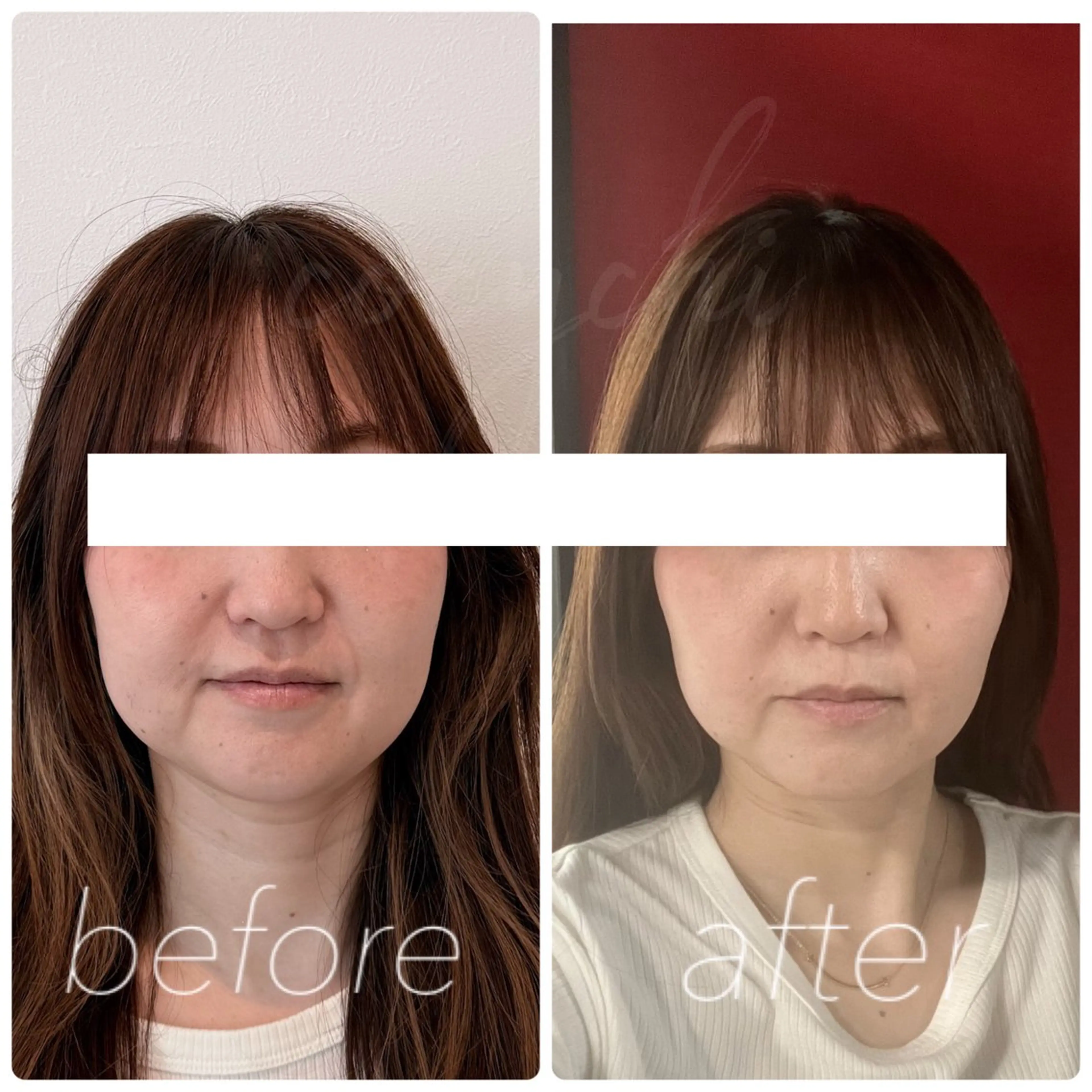 エステ リラク 小顔と ヘッドスパのお店のエステ・リラクイメージ