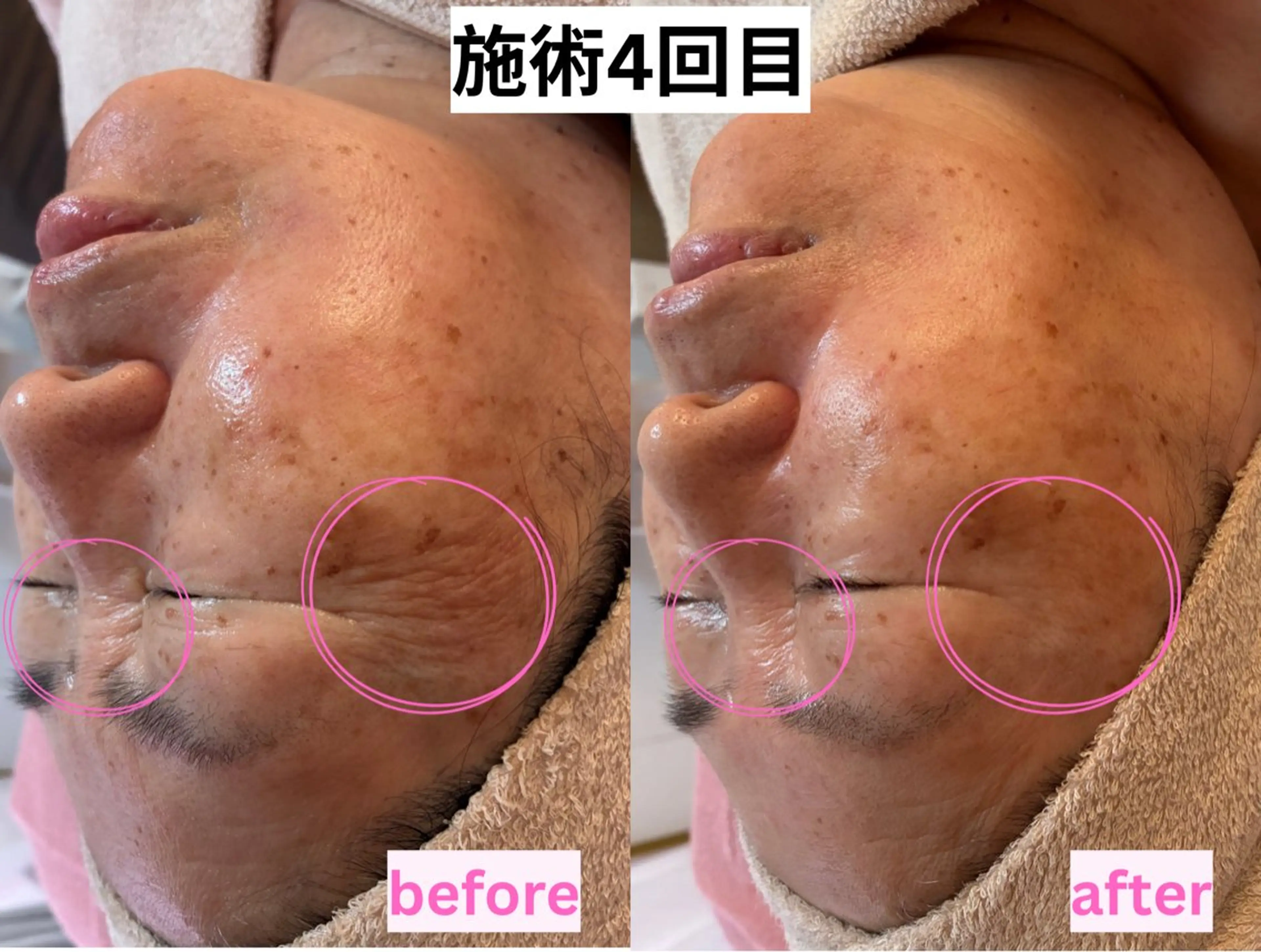 エステ アドミーロ 🎀CHIKA🎀のエステ・リラクイメージ