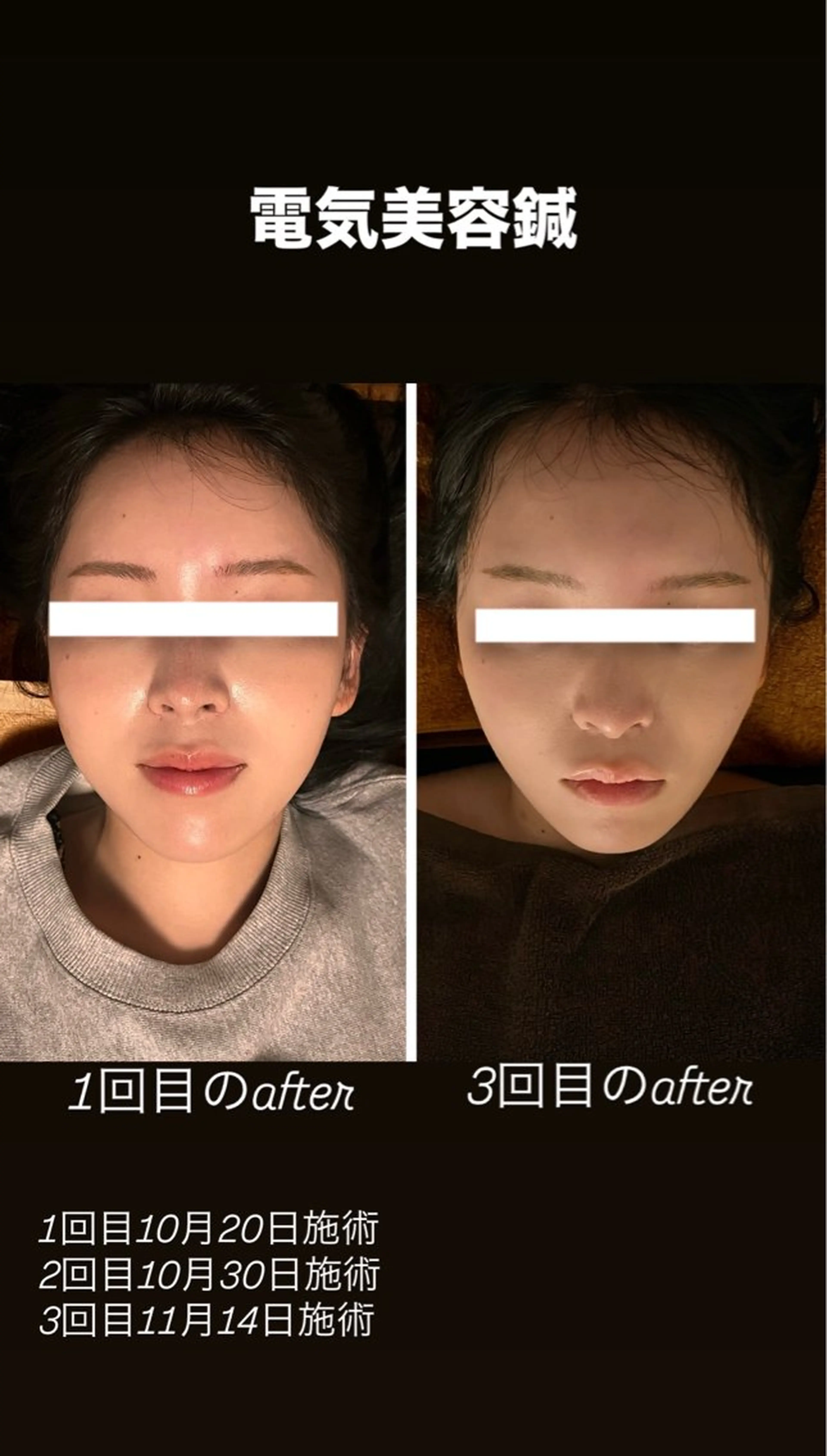 鍼灸リラクゼーション サロン優癒のエステ・リラクイメージ