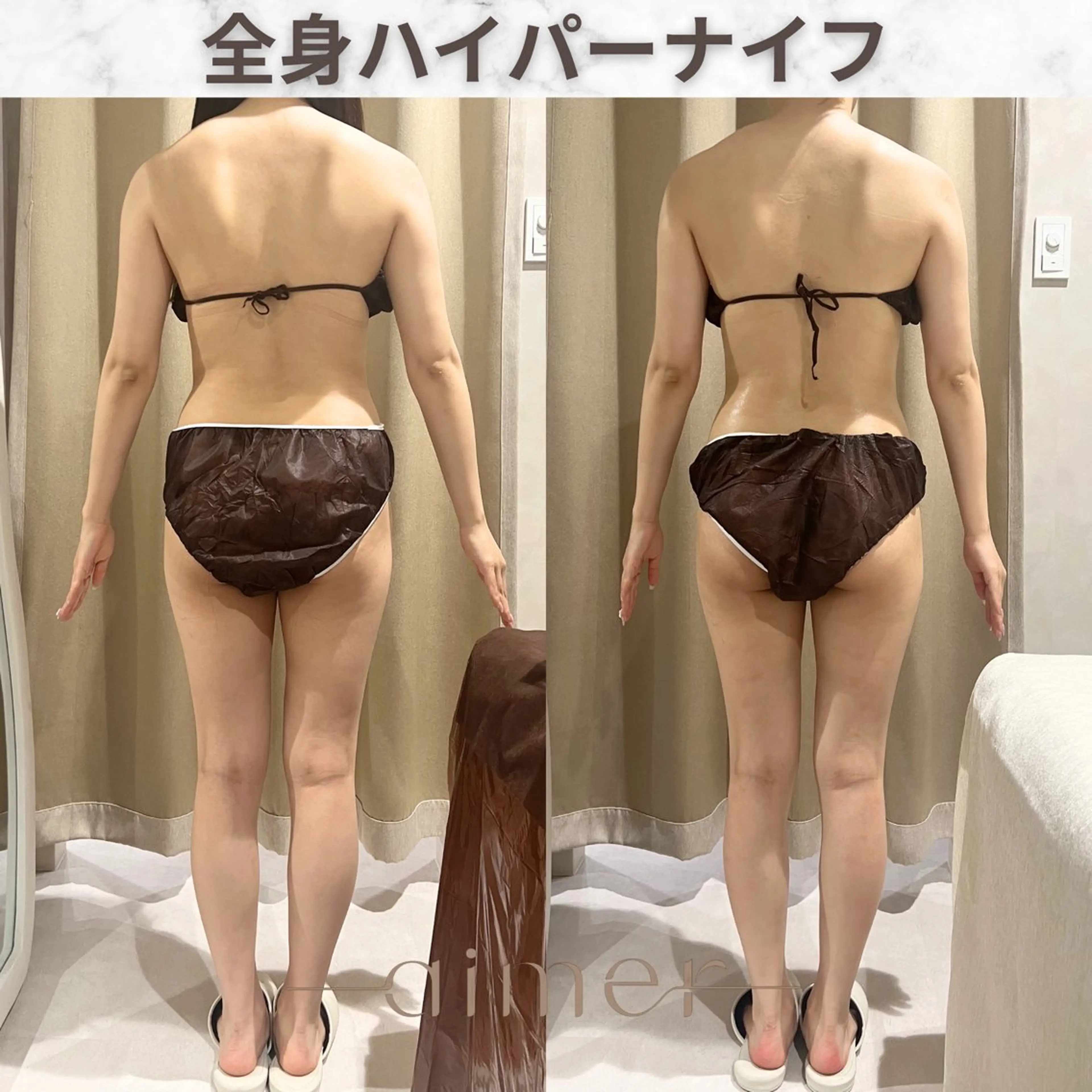 エステ aimer服部 /  小顔 ・ 痩身のその他イメージ