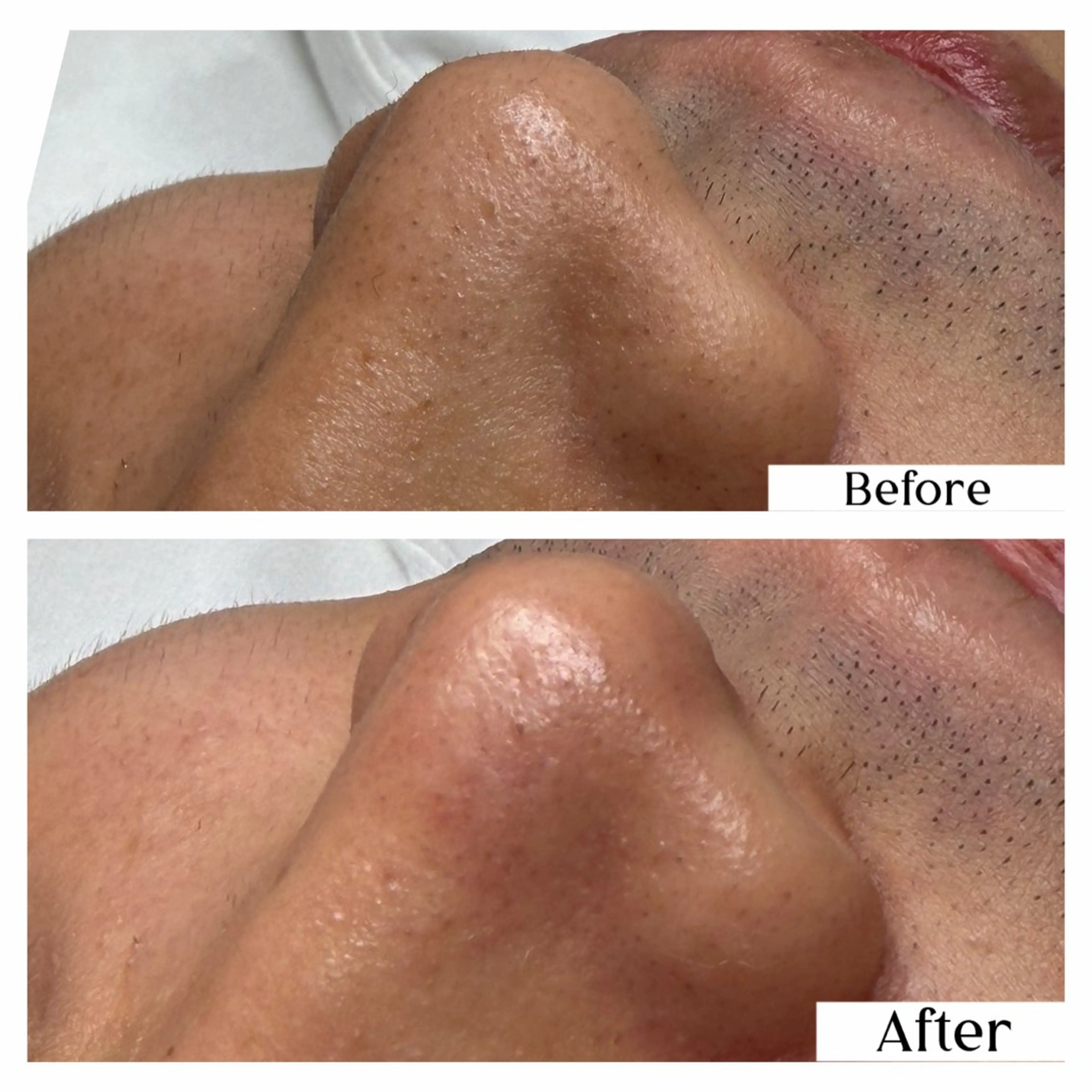 その他 Hémireve Shirokane所属・トロイアルケ🩵 美眉EMIの眉毛・アイブロウイメージ