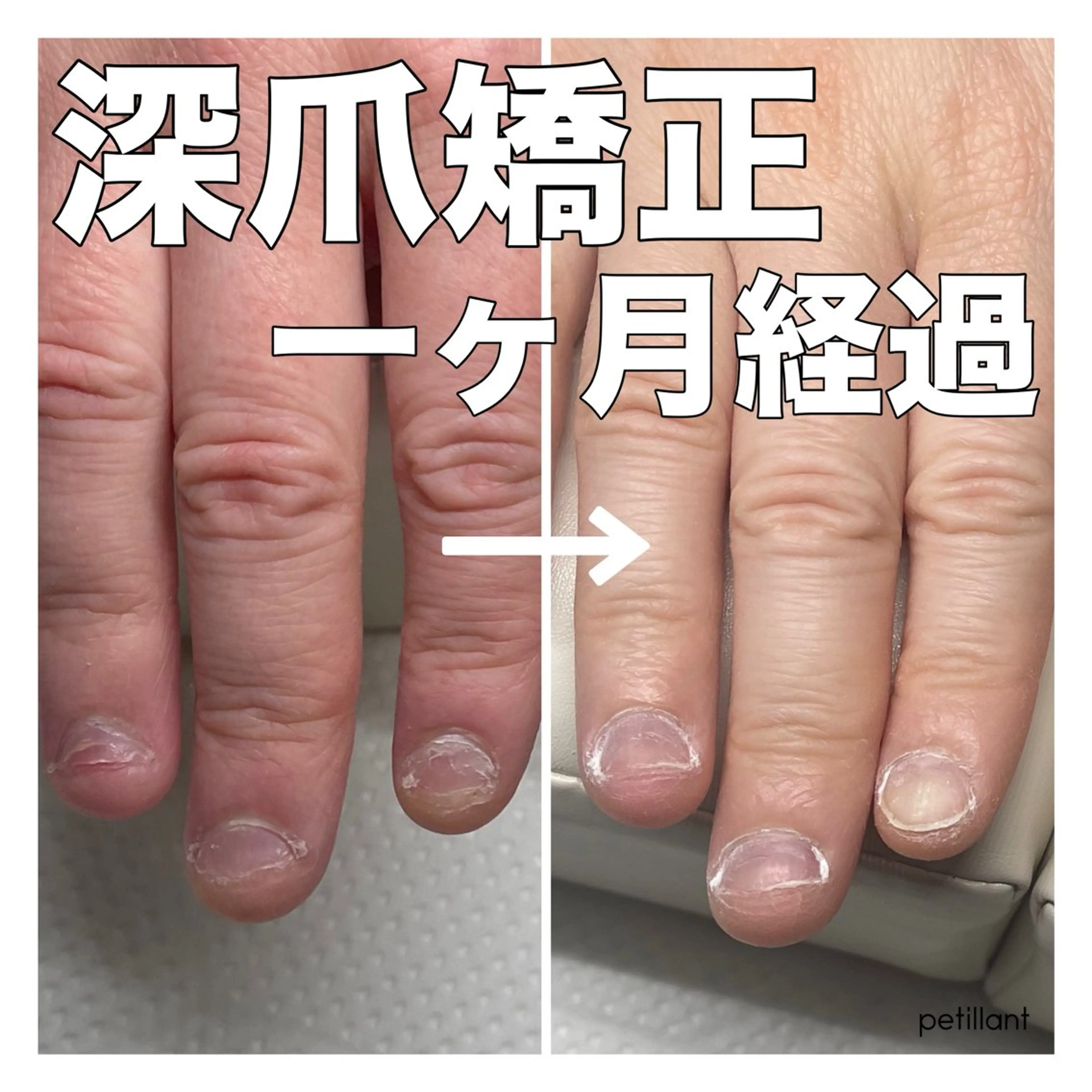 ネイル 長さ出し ジェルネイル ハンドネイル ハンドケア petillant所属・nail salon petillantのネイルデザイン