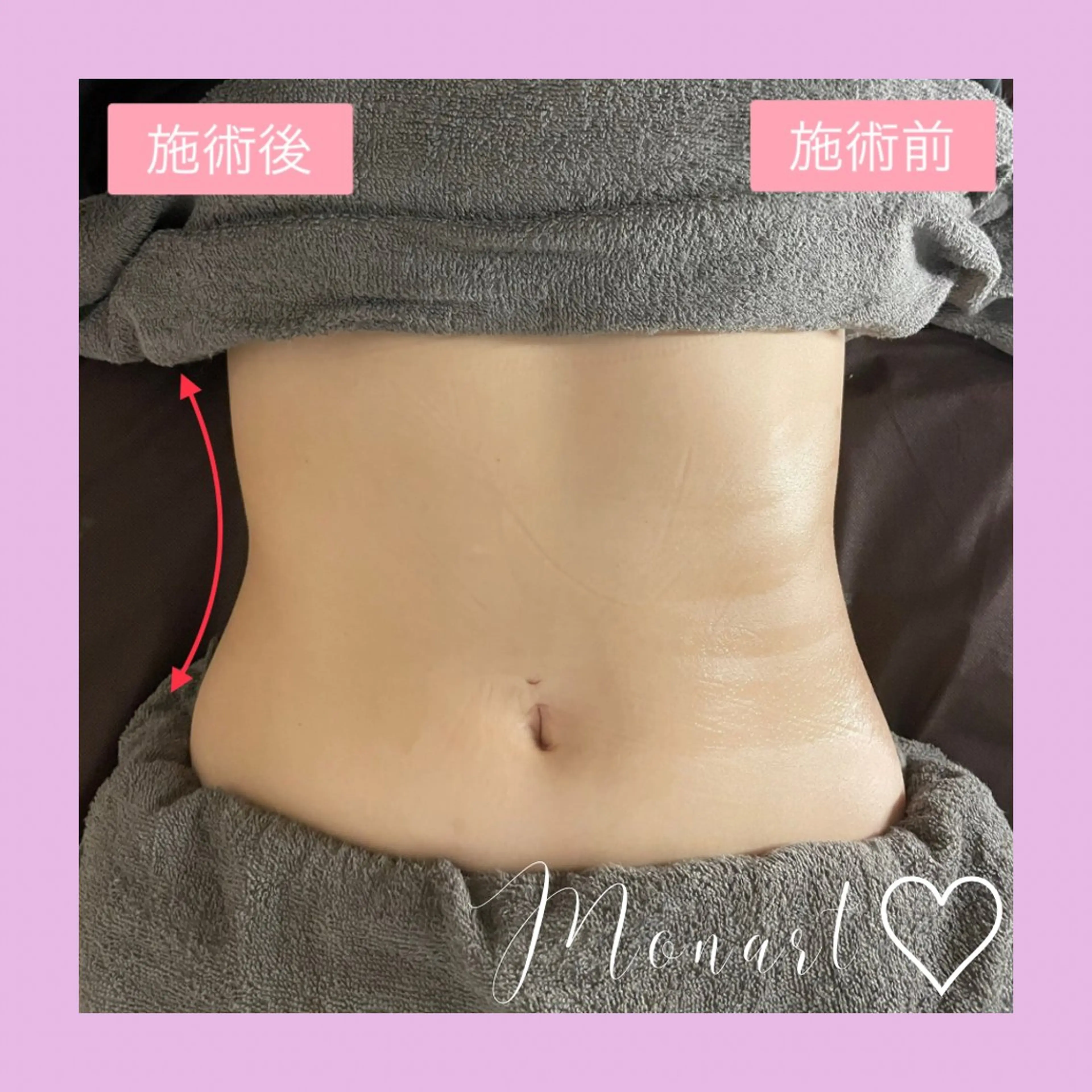 Monart -deux-のエステ・リラクイメージ