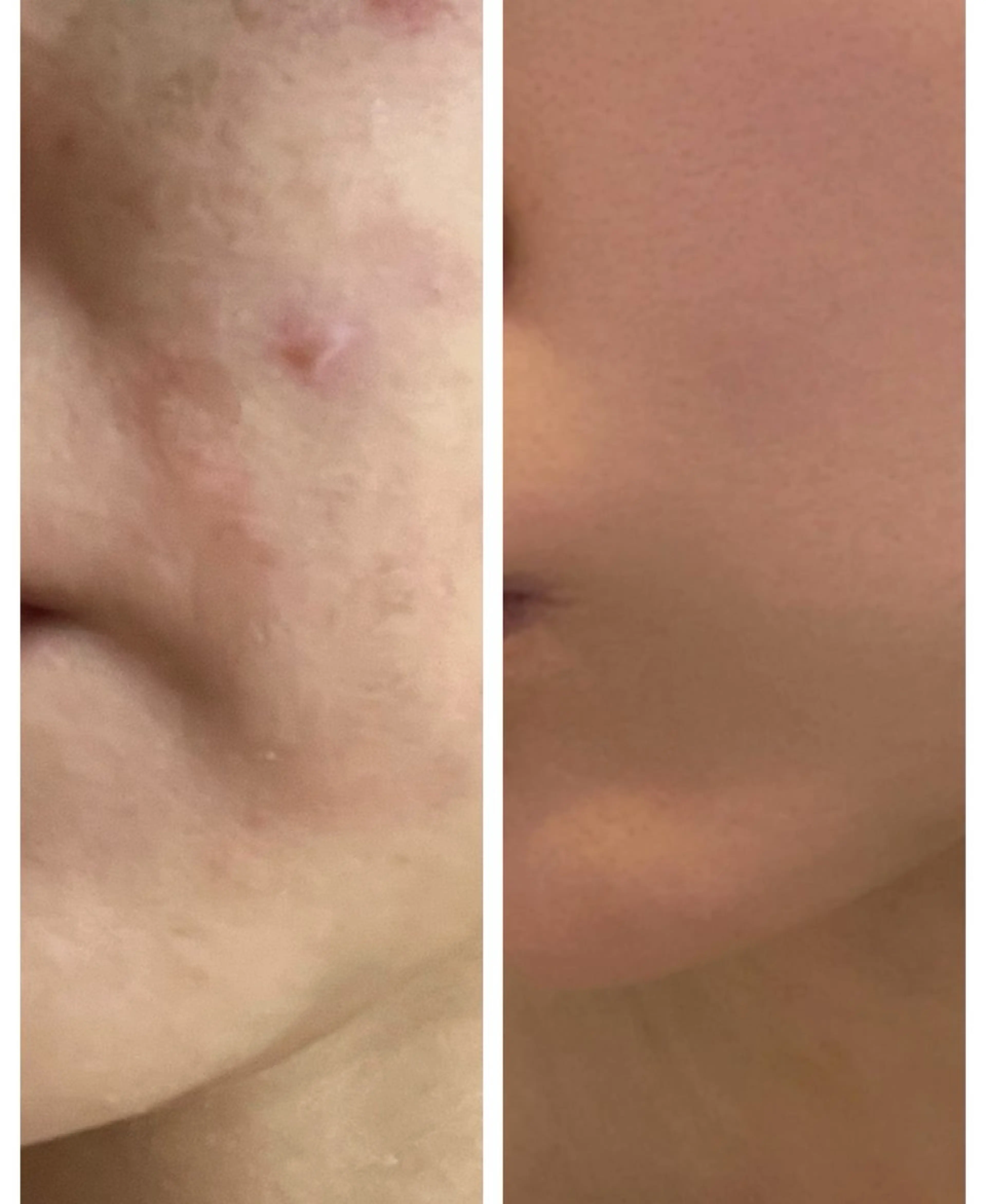 エステ 🅖🅤🅩🅔🅛 salonのエステ・リラクイメージ