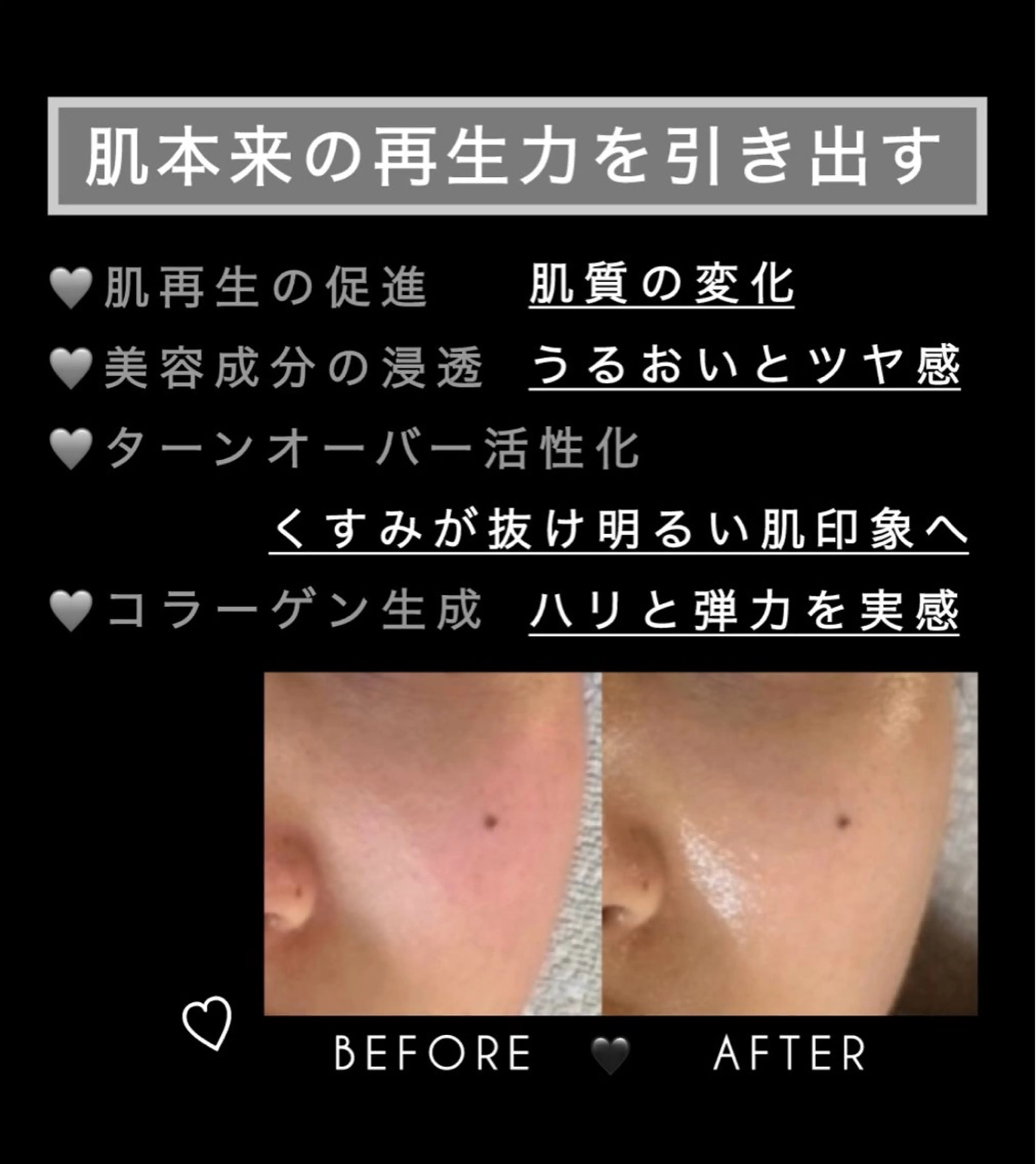 エステ ヴィーナス ビューティーのエステ・リラクイメージ