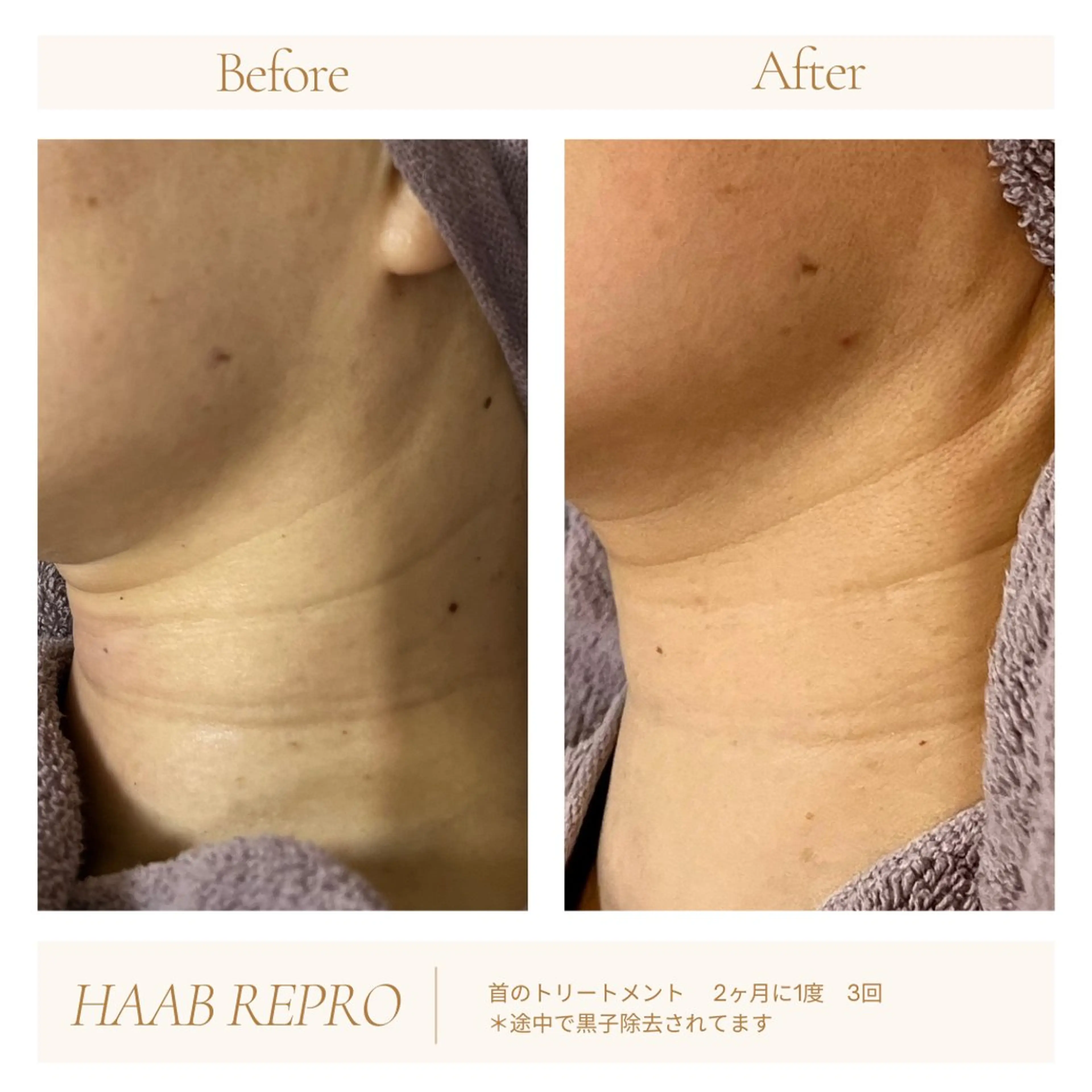 1ヶ月後も半分残る 高持続LEDエクステのマツエク・マツパデザイン