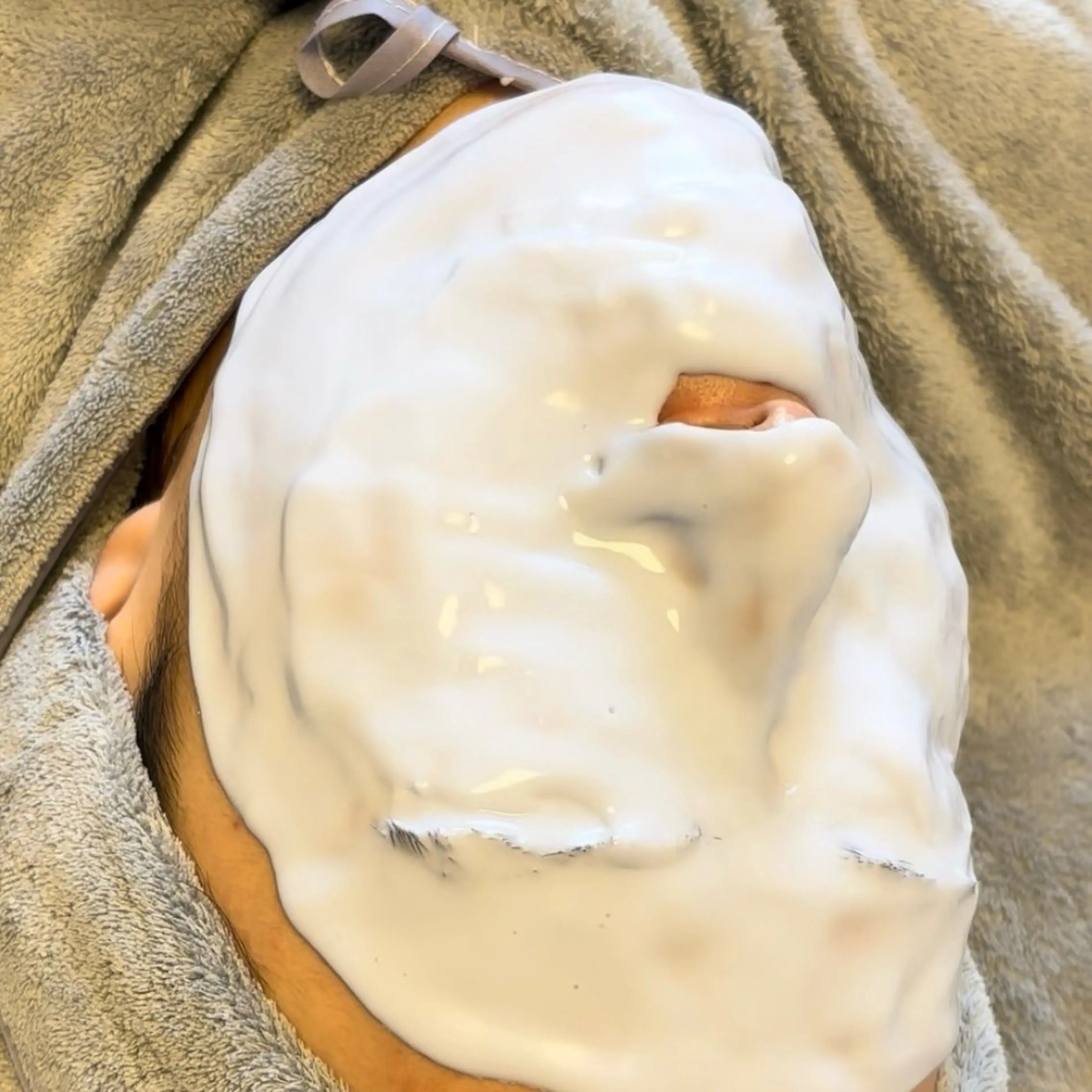 顔全体毛穴洗浄の写真