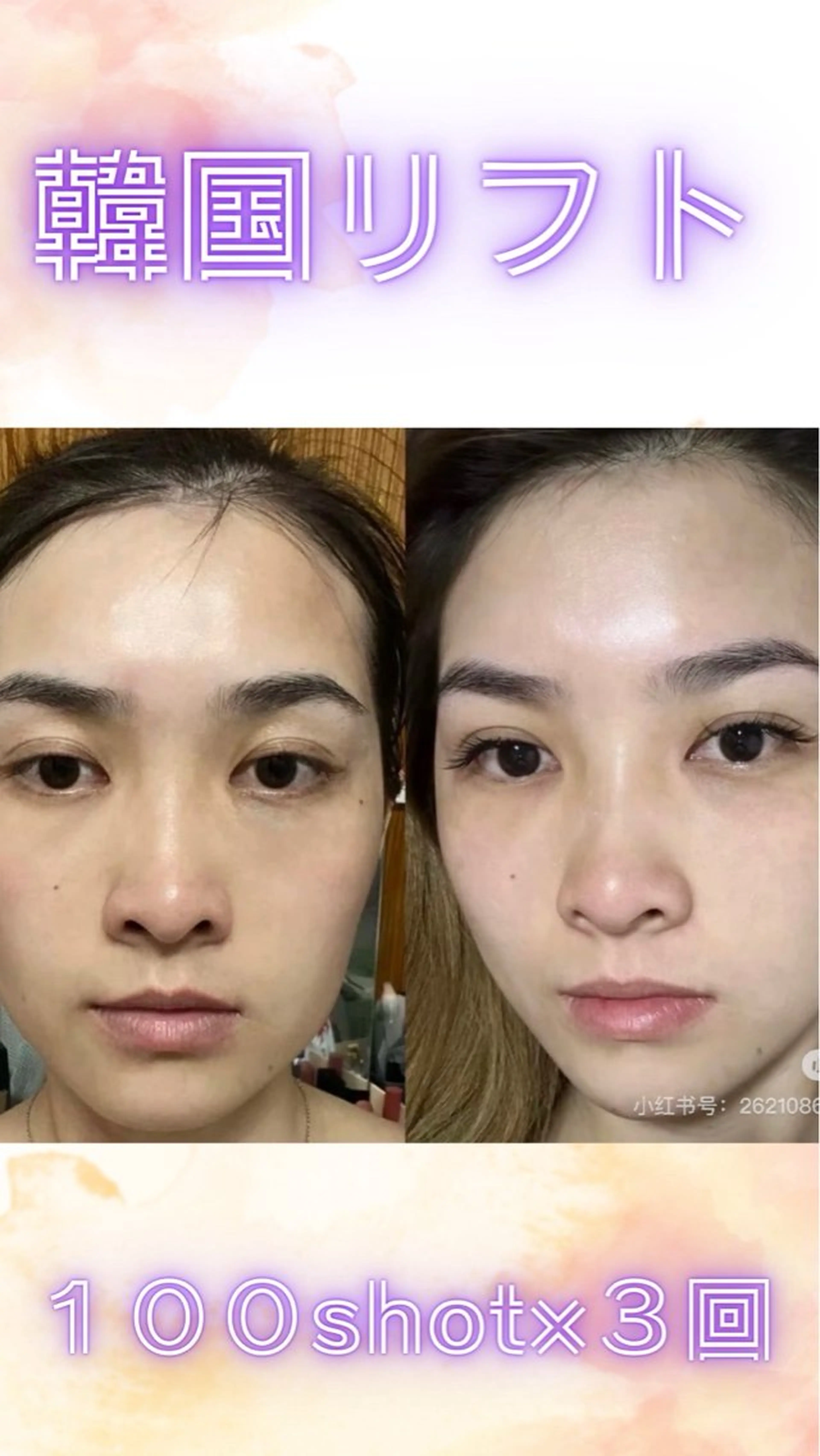 マツエク・マツパ 結婚式・ブライダル エステ aliaハイフ&水光ジェットサロン所属・aliaハーブ水光店 エステティシャン募集のエステ・リラクイメージ