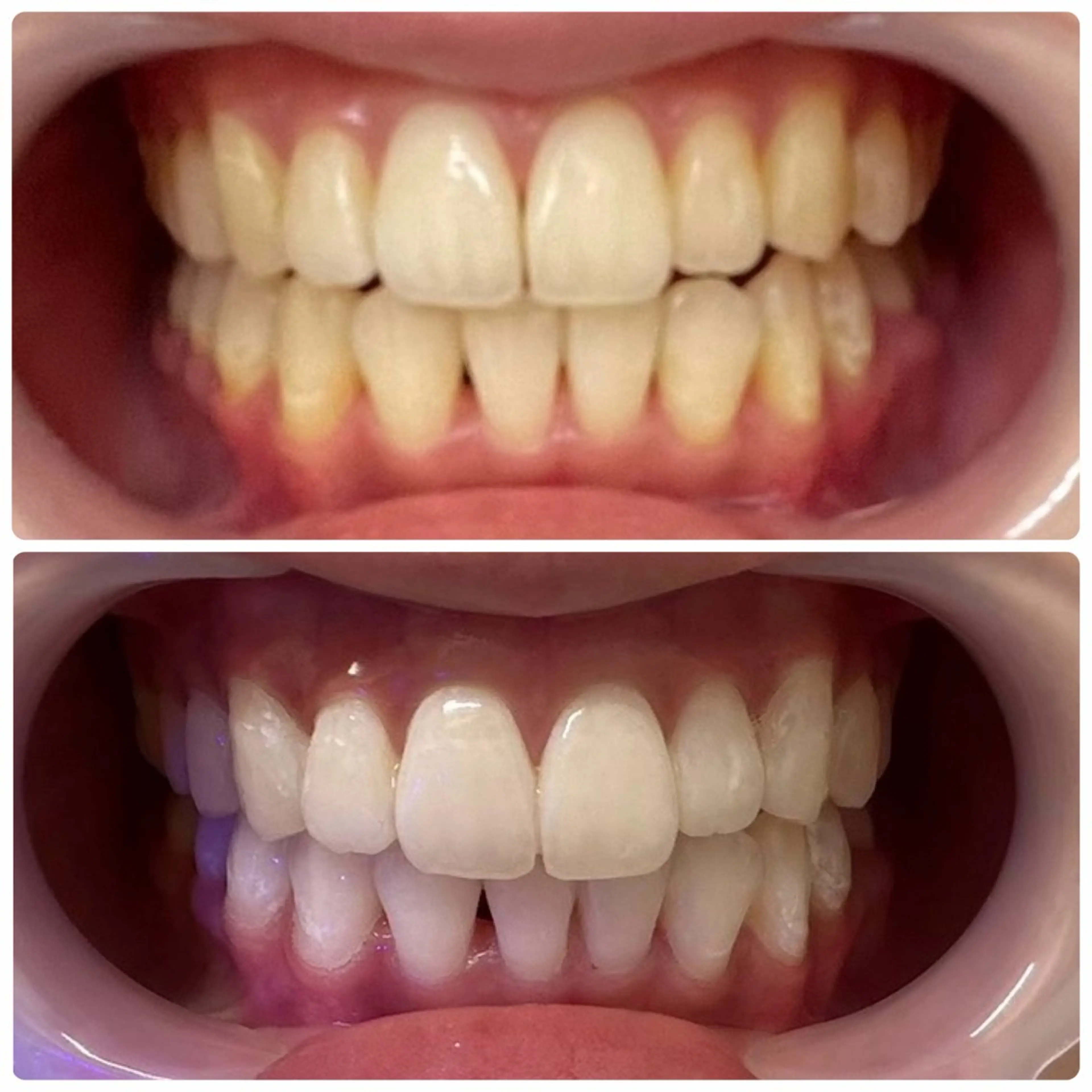 メンズ 学生（メンズ向け） その他 セルフホワイトニング 池袋　プラネットのその他イメージ