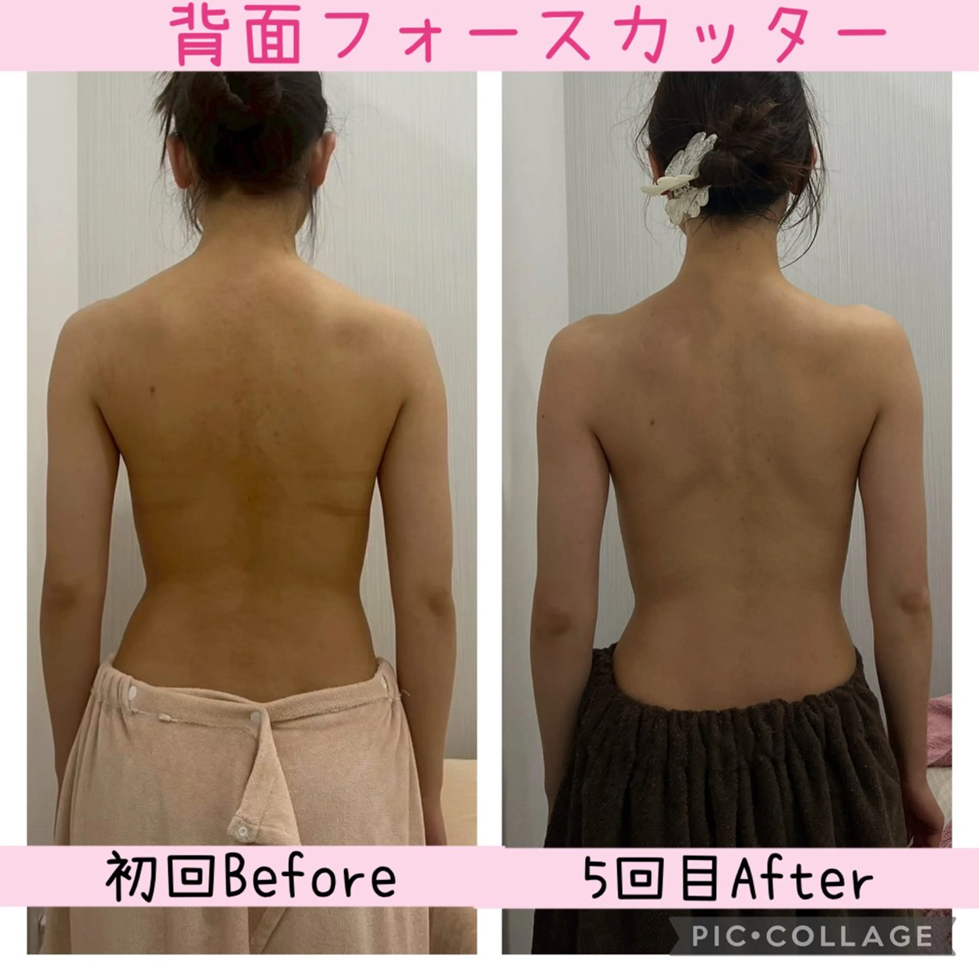 エステ ブライダル痩身×脱毛 尼崎駅前サロンのエステ・リラクイメージ