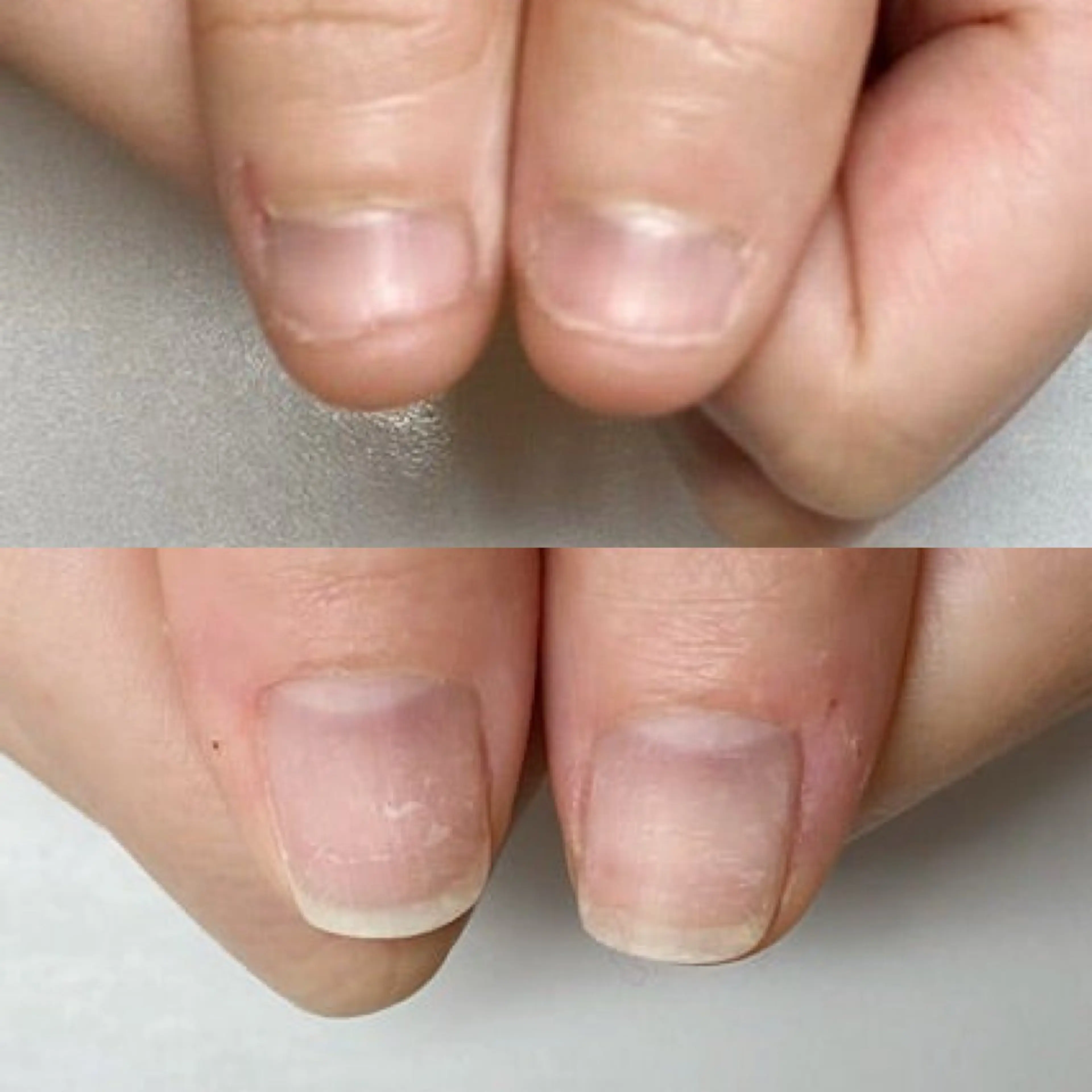 ネイル ネイルサロン アリュームのネイルデザイン