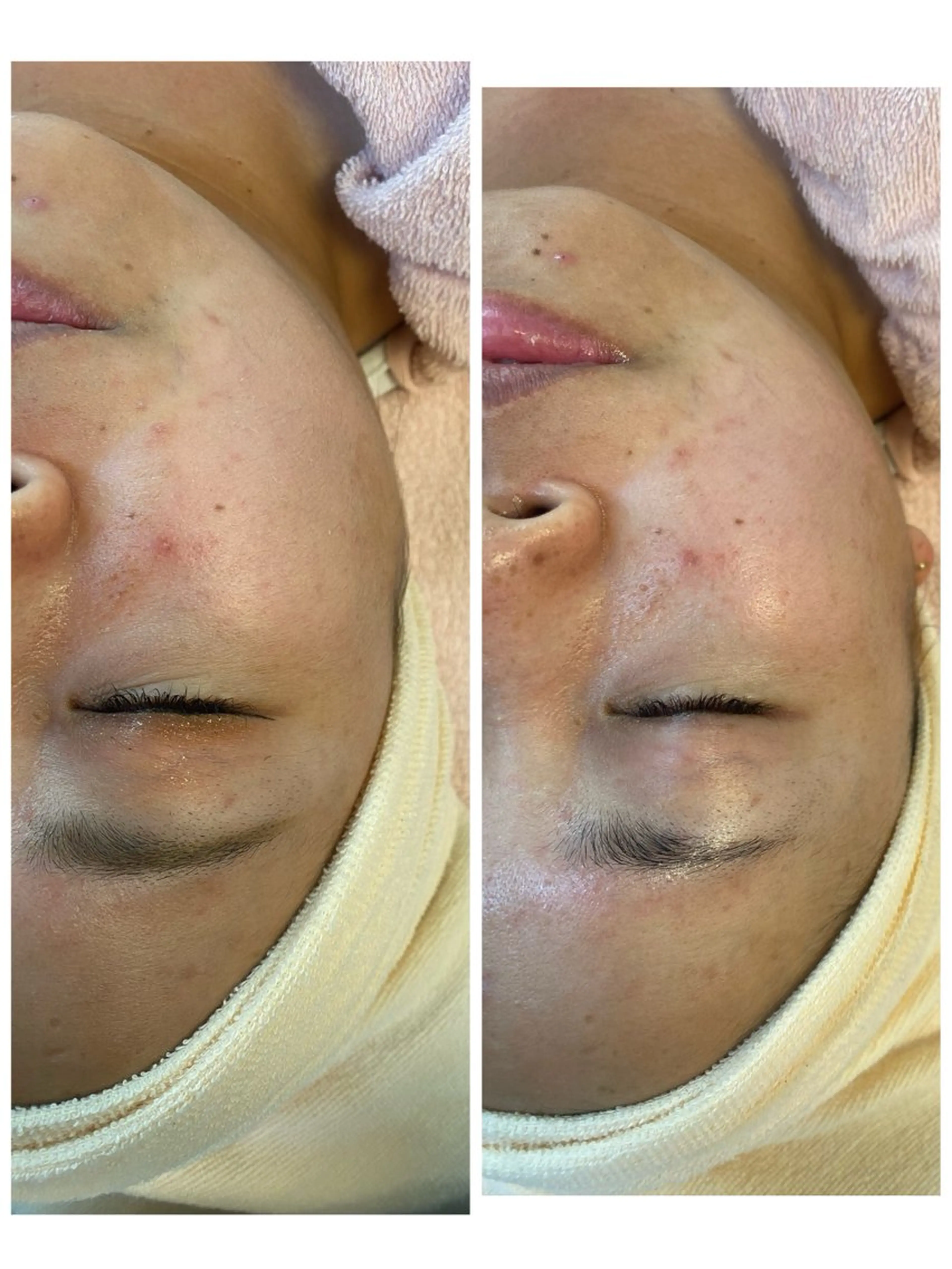 エステ 満本 麻理のエステ・リラクイメージ