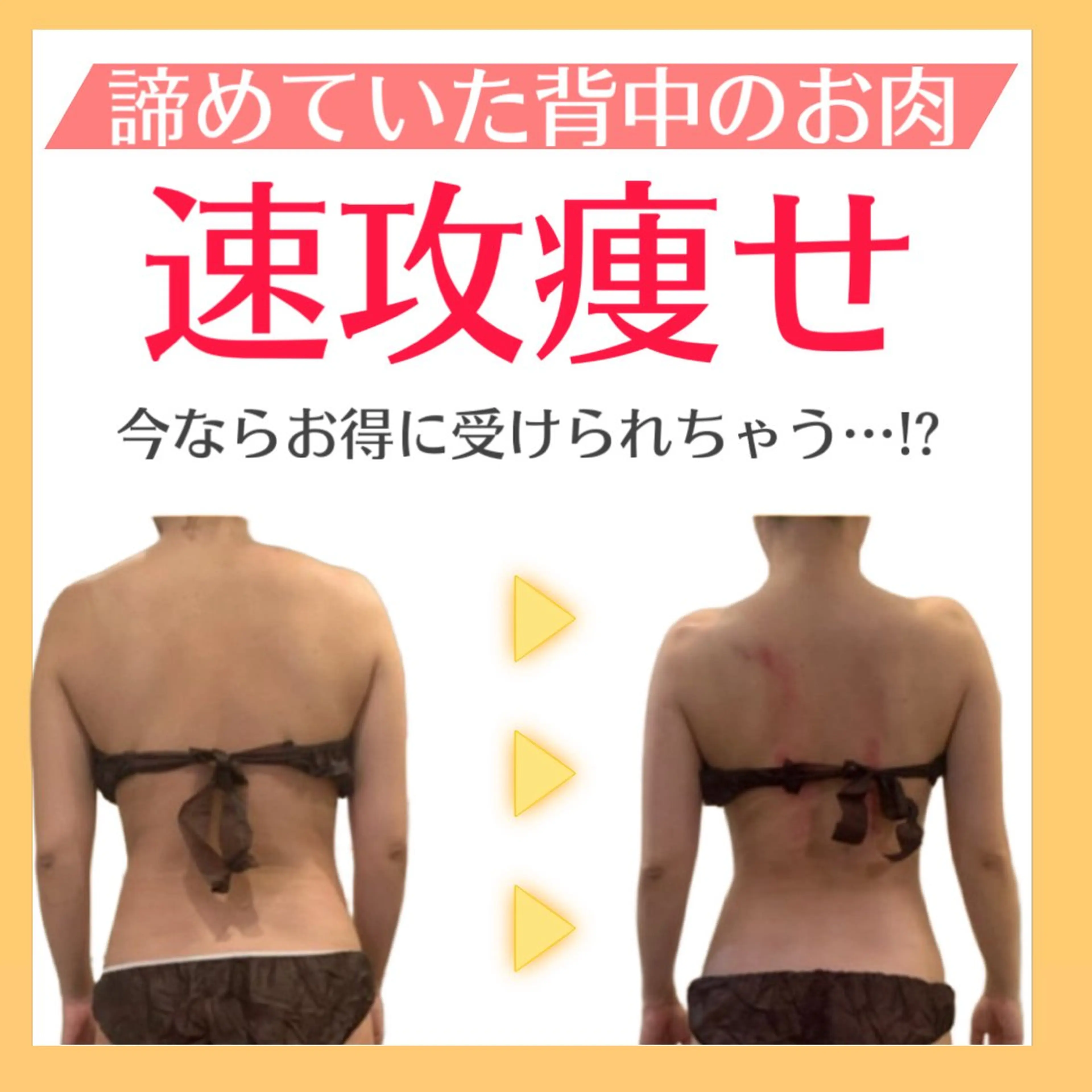 【憧れの華奢背中・二の腕を作る🔥】ダブルの機器で冬でも着膨れしない華奢ボディに⛄️❄️徹底サイズダウン❤️‍🔥の写真