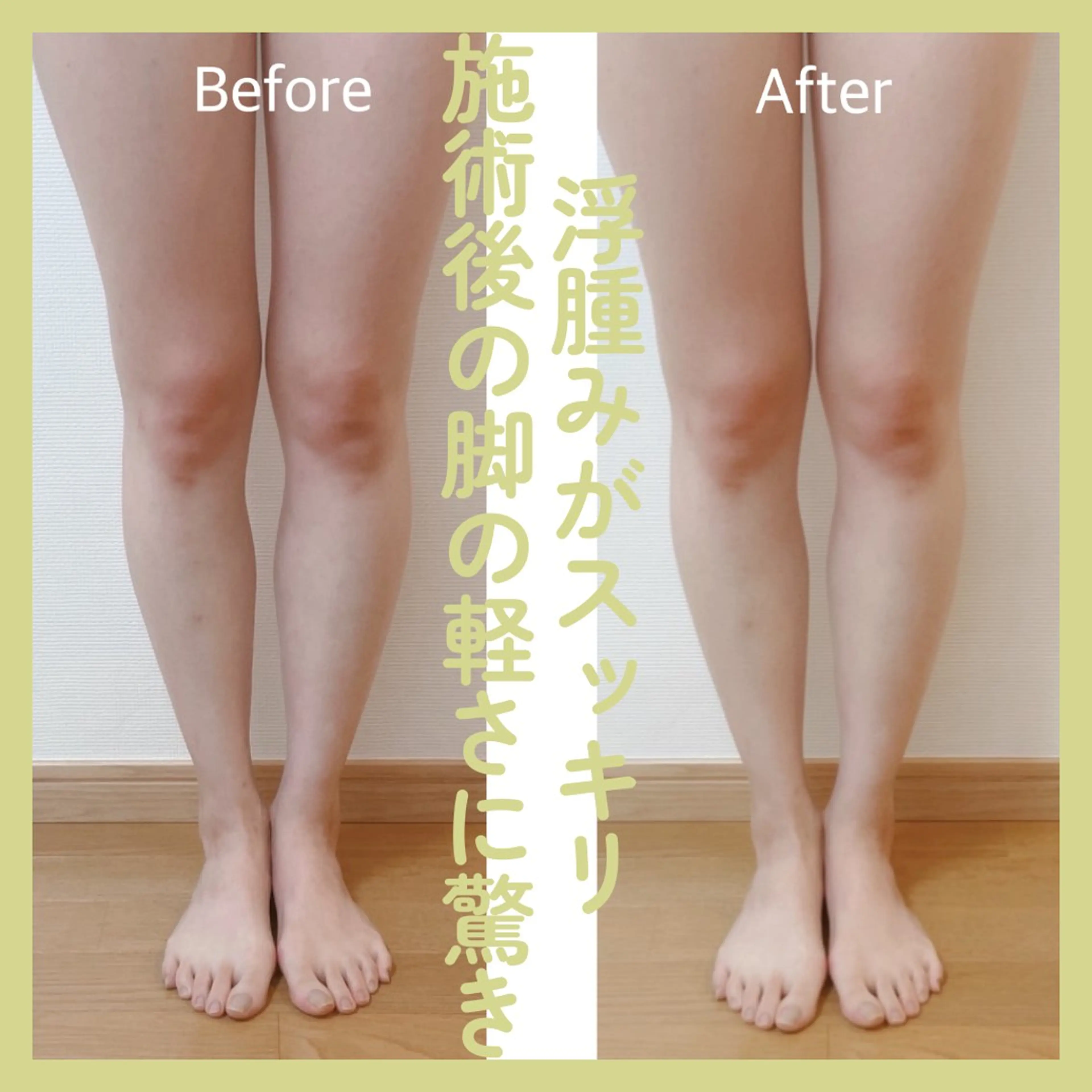 INDIBA 全身の写真