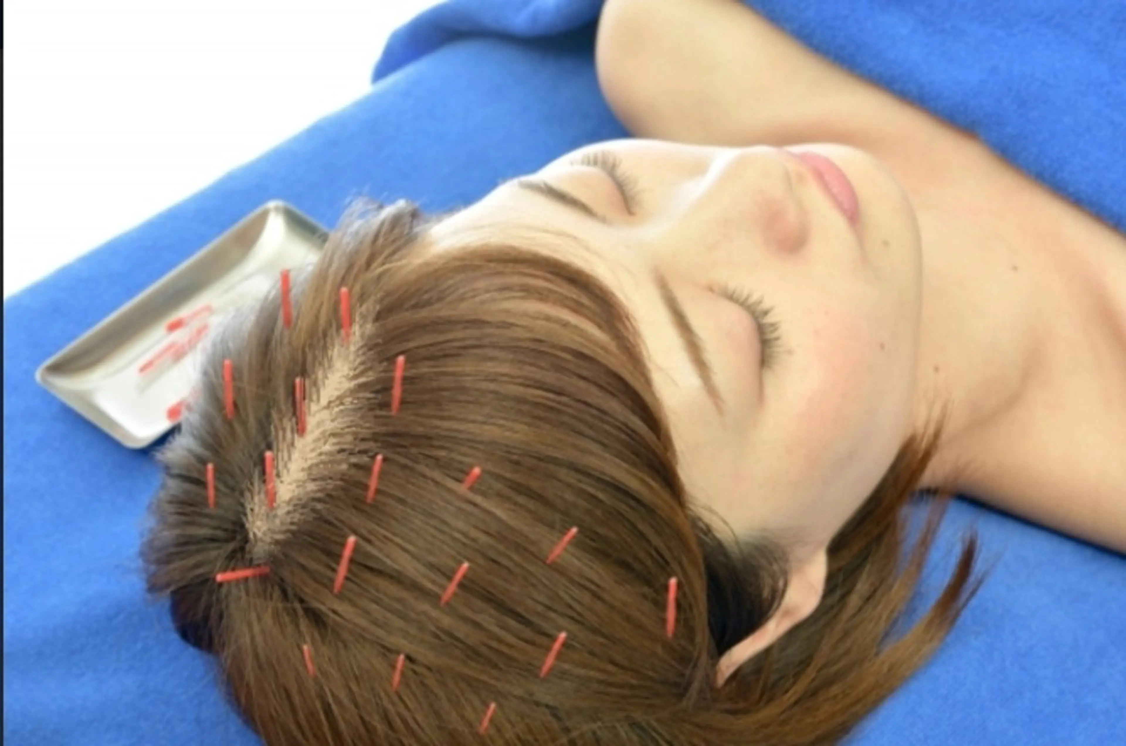 鍼灸・整体・美容鍼  ハリエ　おだのエステ・リラクイメージ