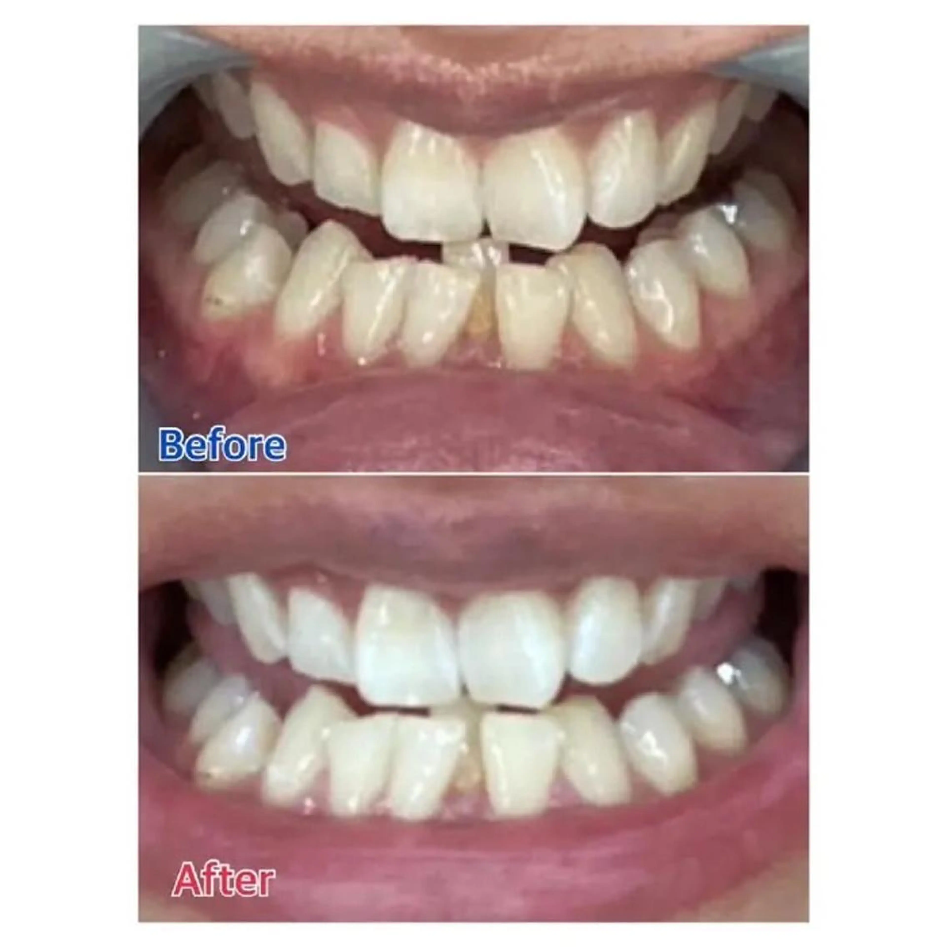 Ｍ渋谷 ホワイトニングのエステ・リラクイメージ