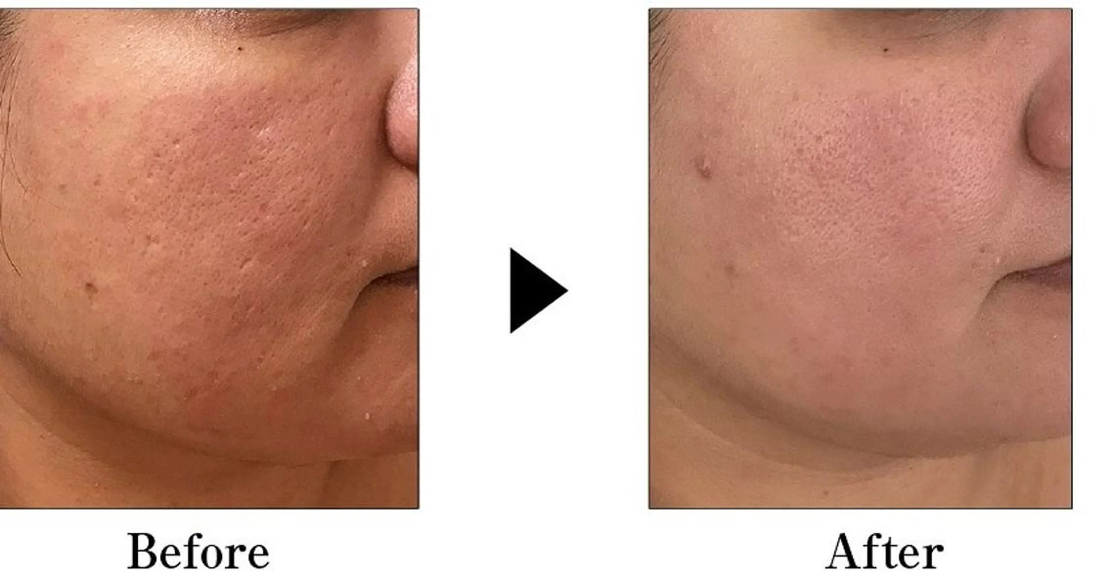 マツエク・マツパ パーマ ネイル キッズ メンズ ミディアム エステ 次世代まつげパーマは 『リベル名古屋』のマツエク・マツパデザイン