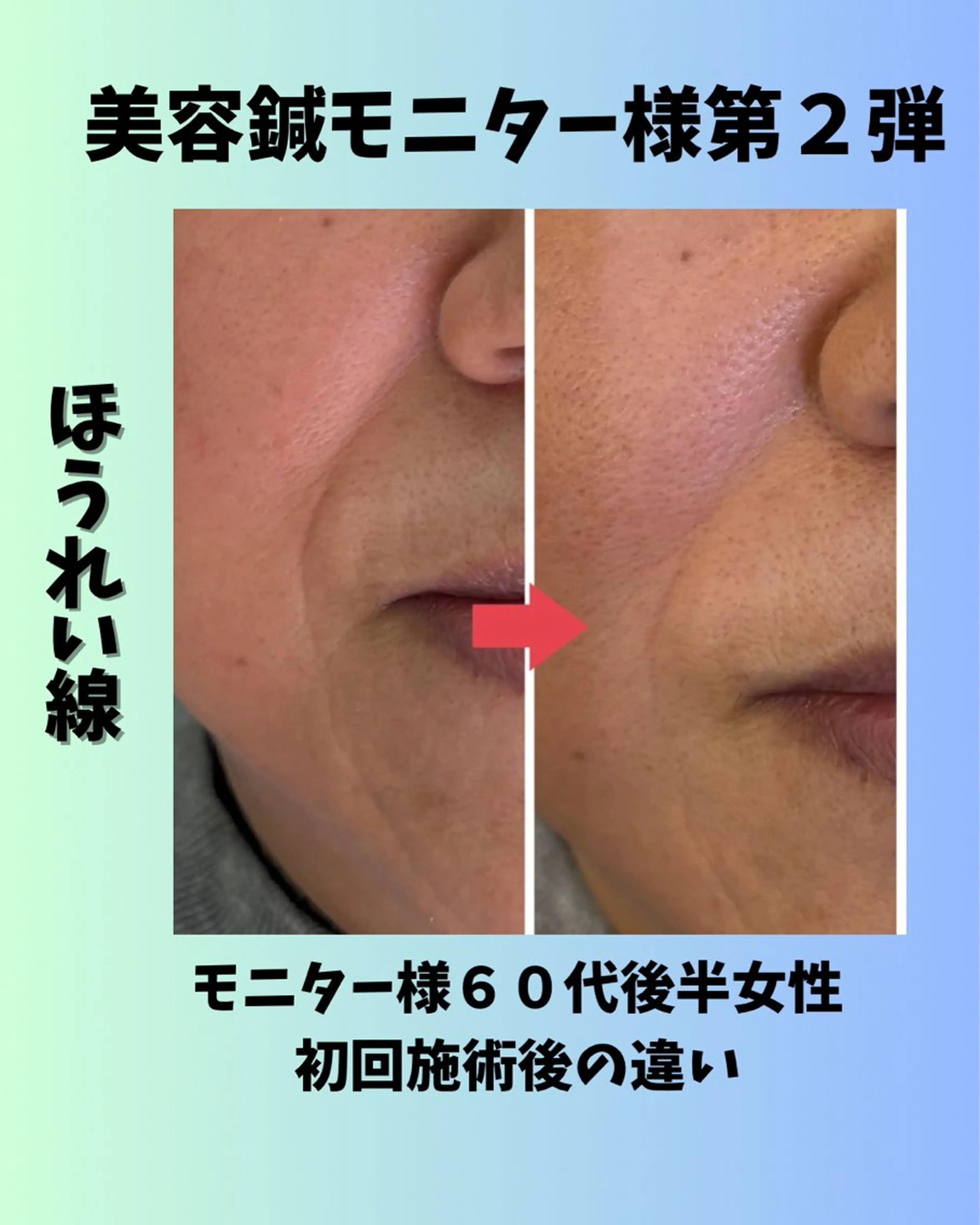 あおぞら 鍼灸整骨院のエステ・リラクイメージ