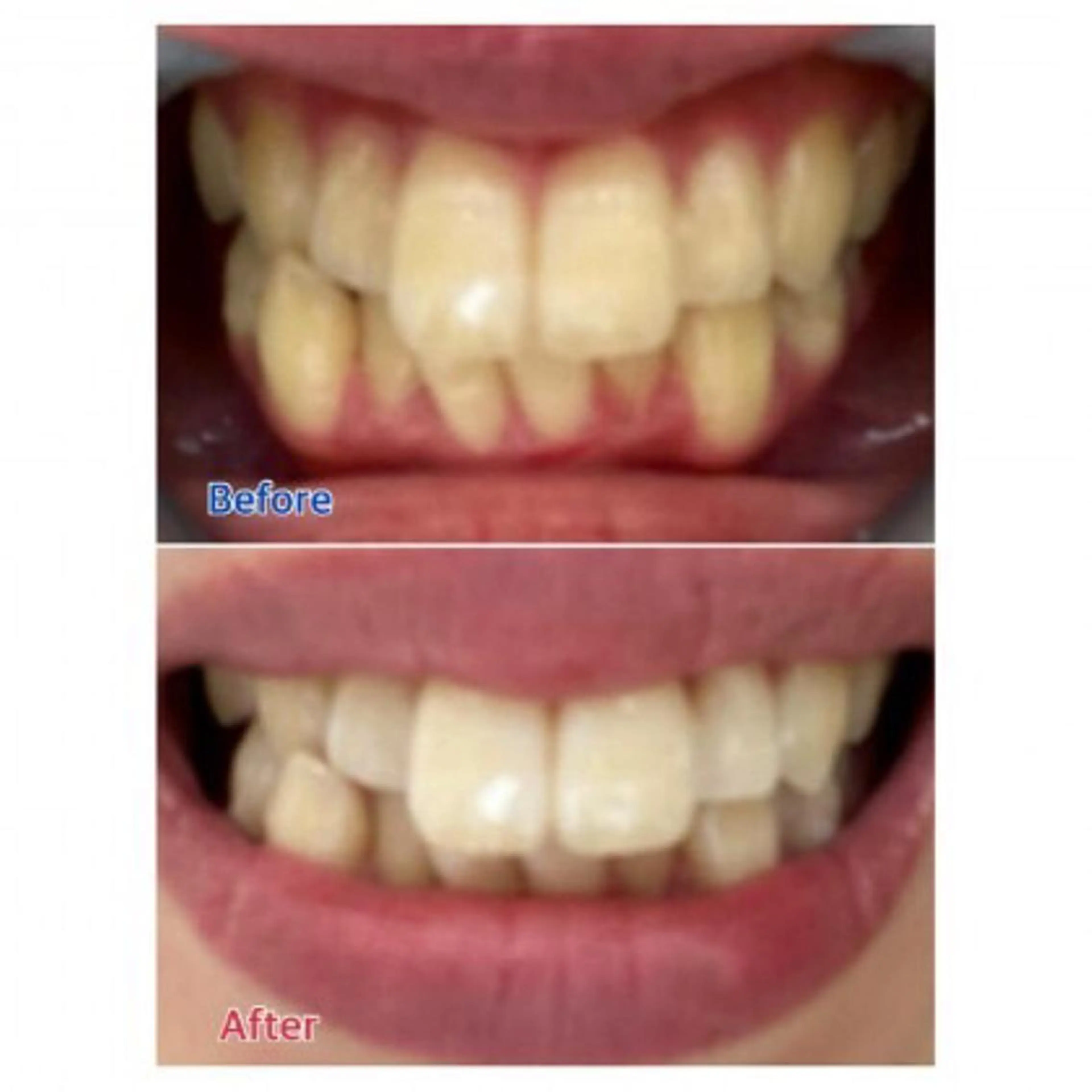 Ｍ渋谷 ホワイトニングのエステ・リラクイメージ