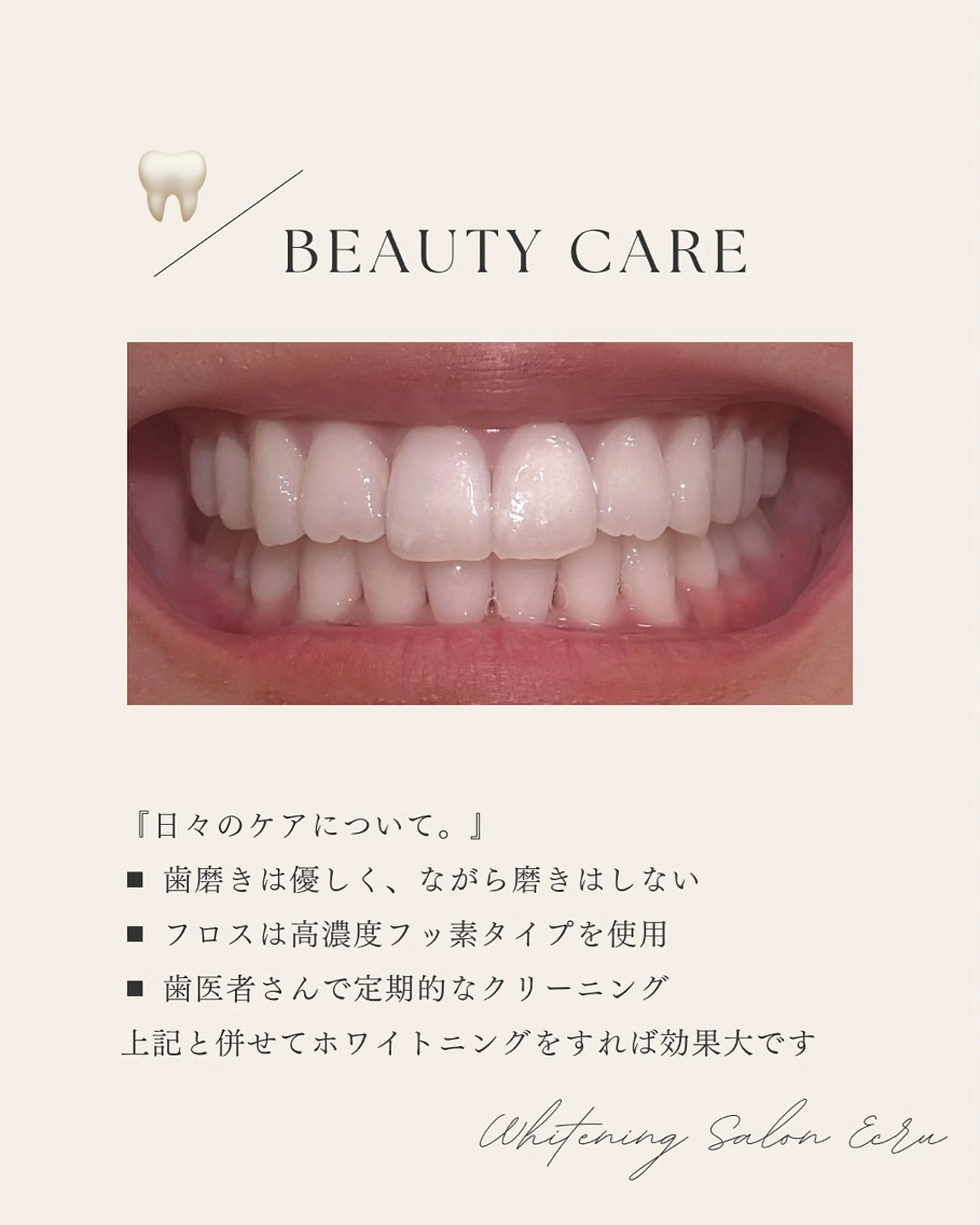 メンズ キッズ ホワイトニングサロン Ecru所属・ホワイトニングサロン Ecru エクリュのその他イメージ