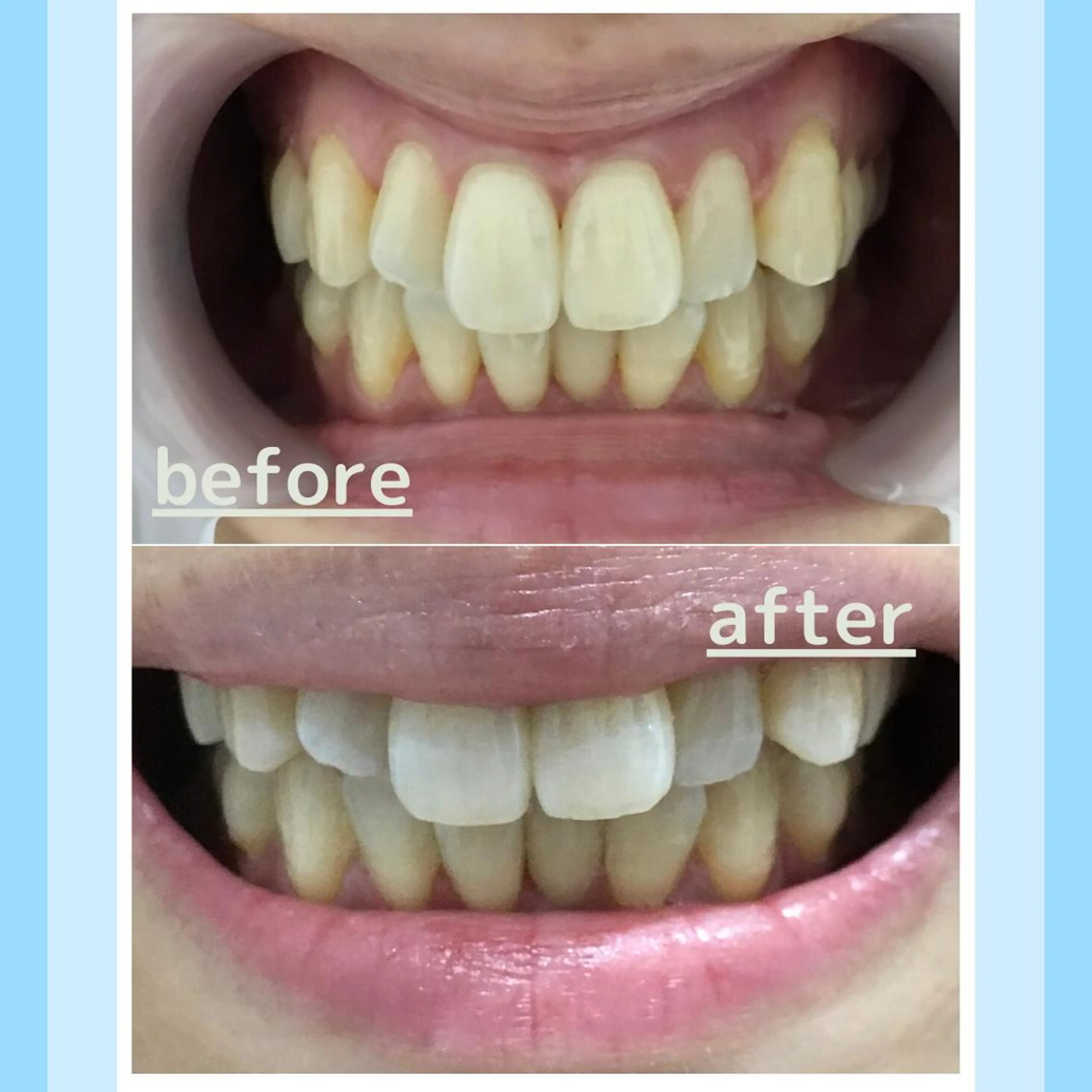 メンズ お手軽ホワイトニングsalon mina所属・武元 奈津美のその他イメージ