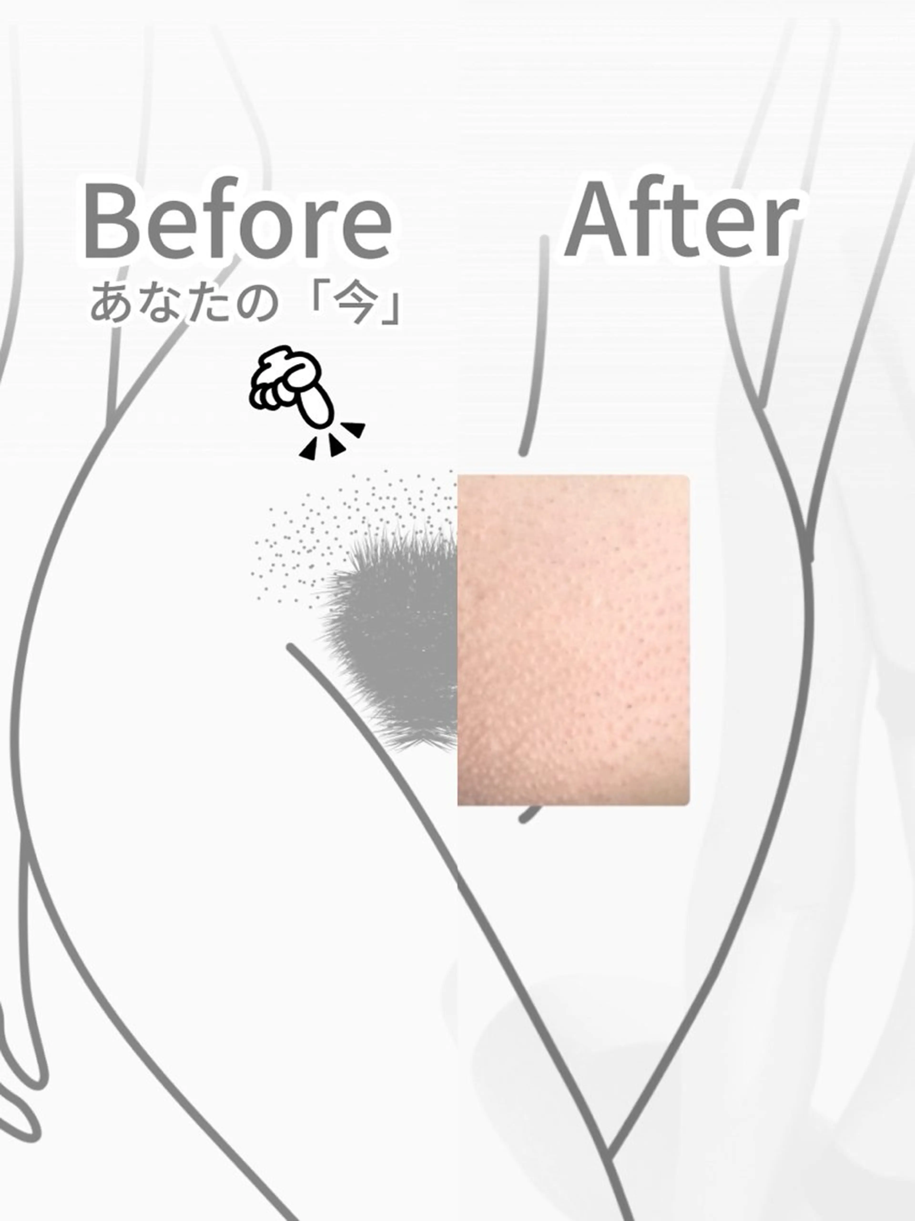 Hitomi シュガーリング豊橋のその他イメージ