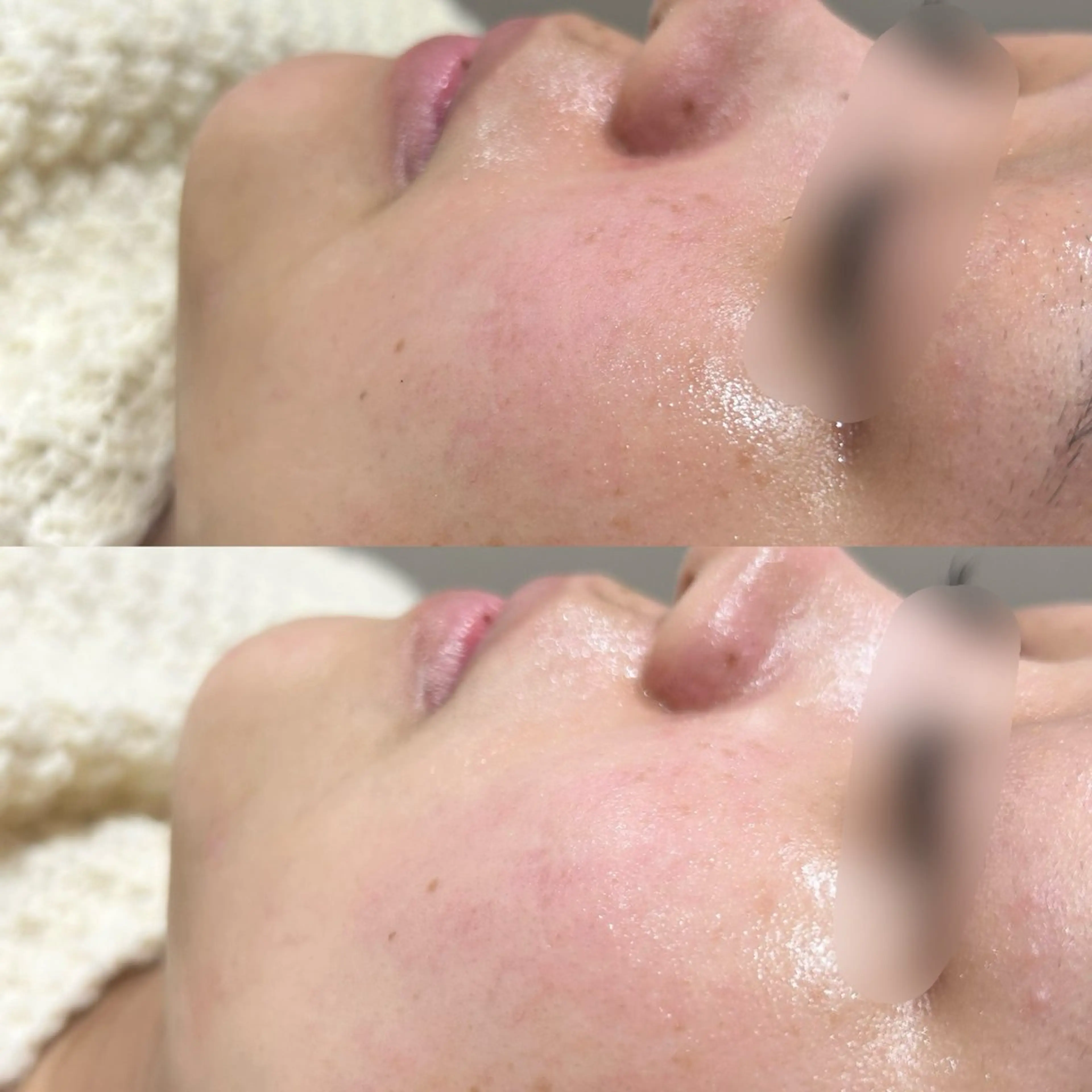 エステ EARTH 小林 郁海のエステ・リラクイメージ