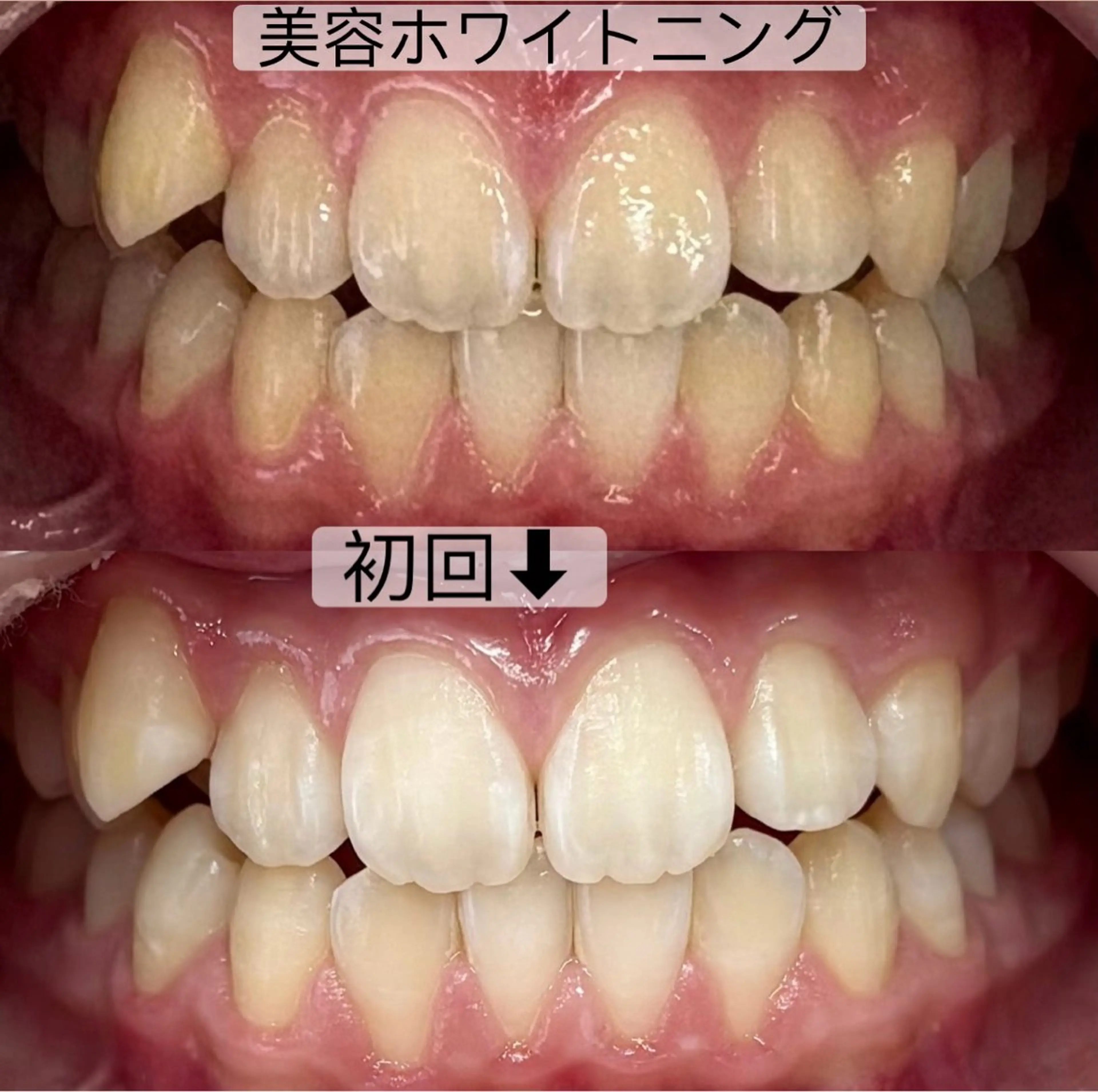 その他 whitening salon yatto.所属・ホワイトニングサロン yatto.のその他イメージ