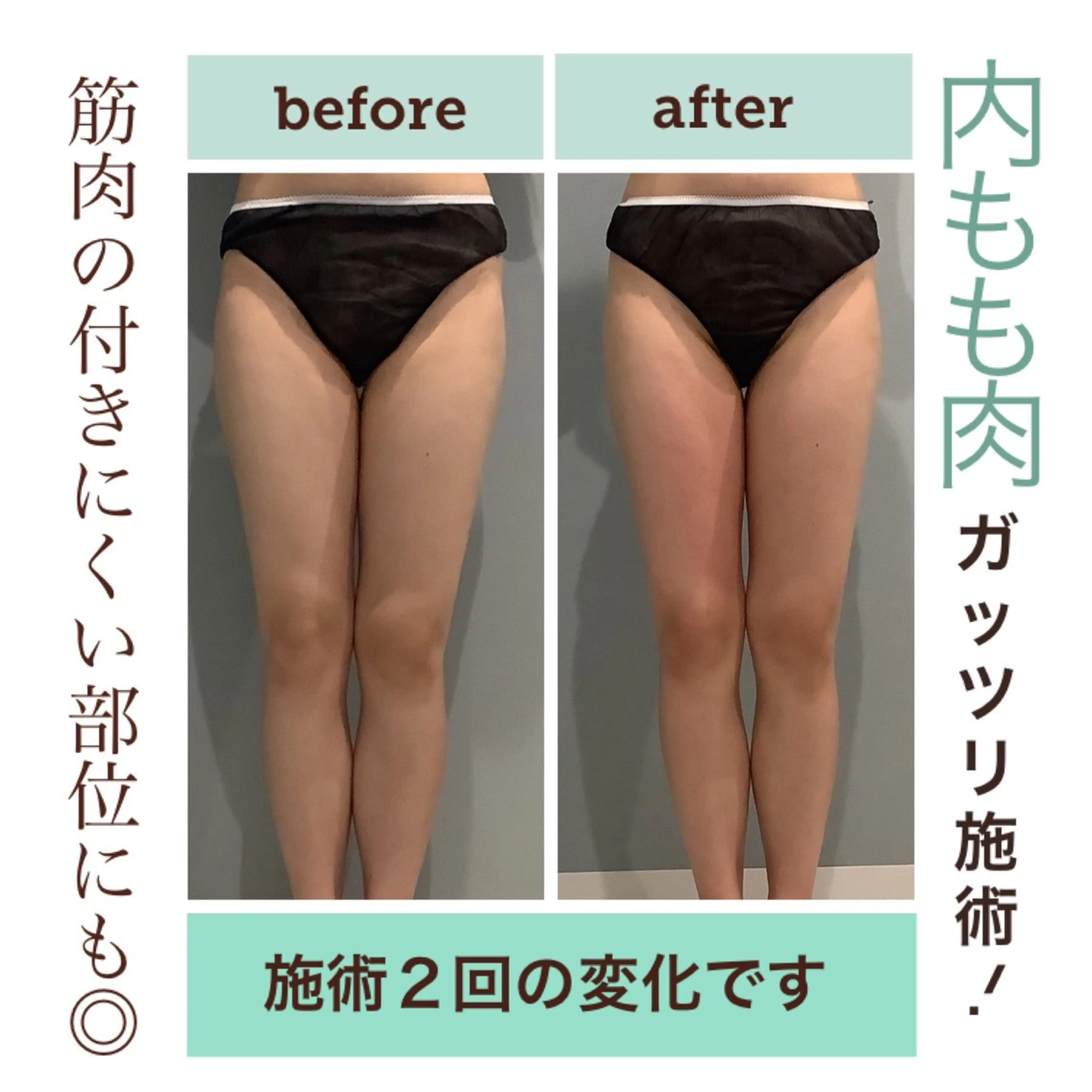 エステ エステサロン JURISのエステ・リラクイメージ