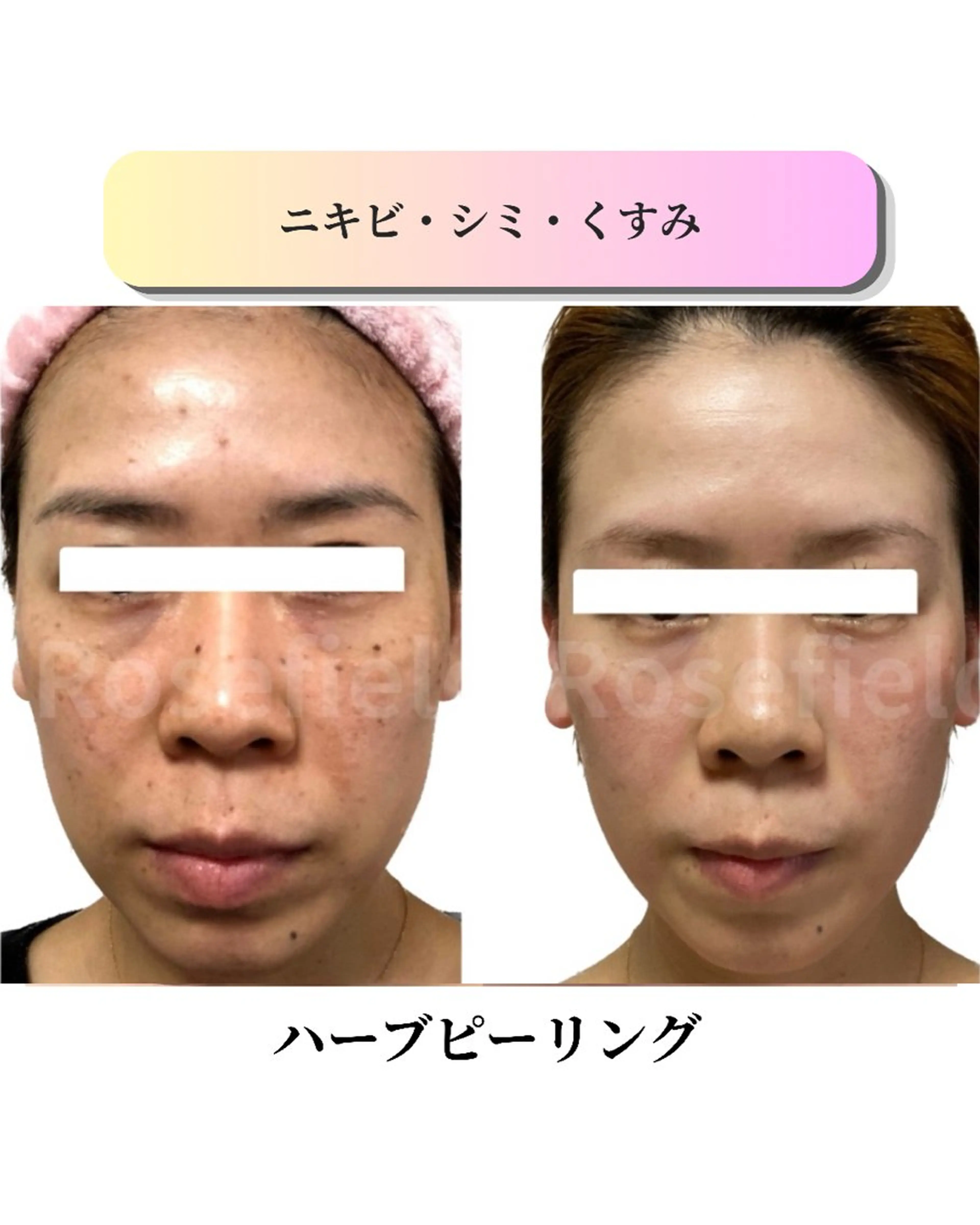 エステ ローズフィールド 森岡朋美のエステ・リラクイメージ