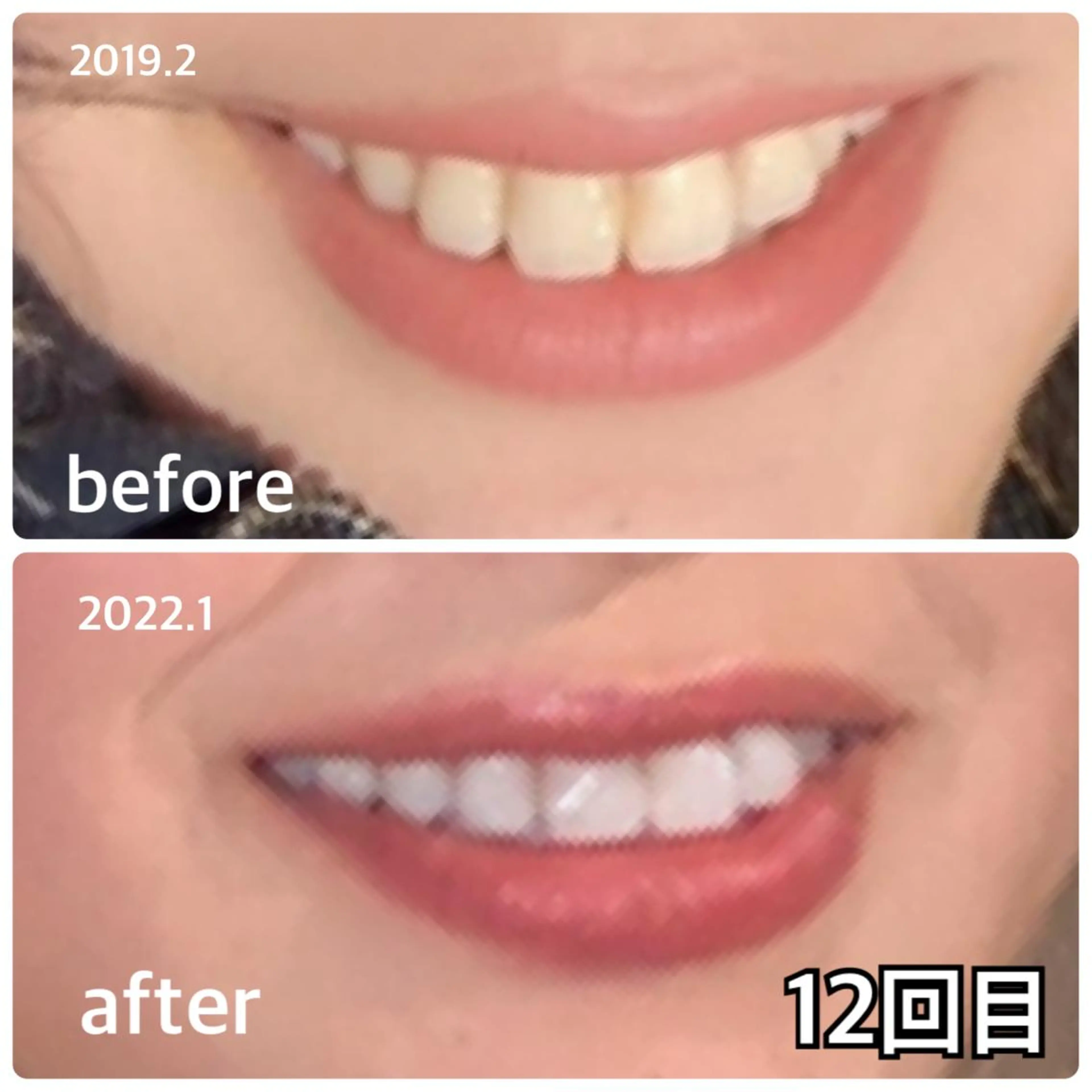 ホワイトニングラウンジ横須賀所属・ホワイトニング Lounge横須賀のエステ・リラクイメージ