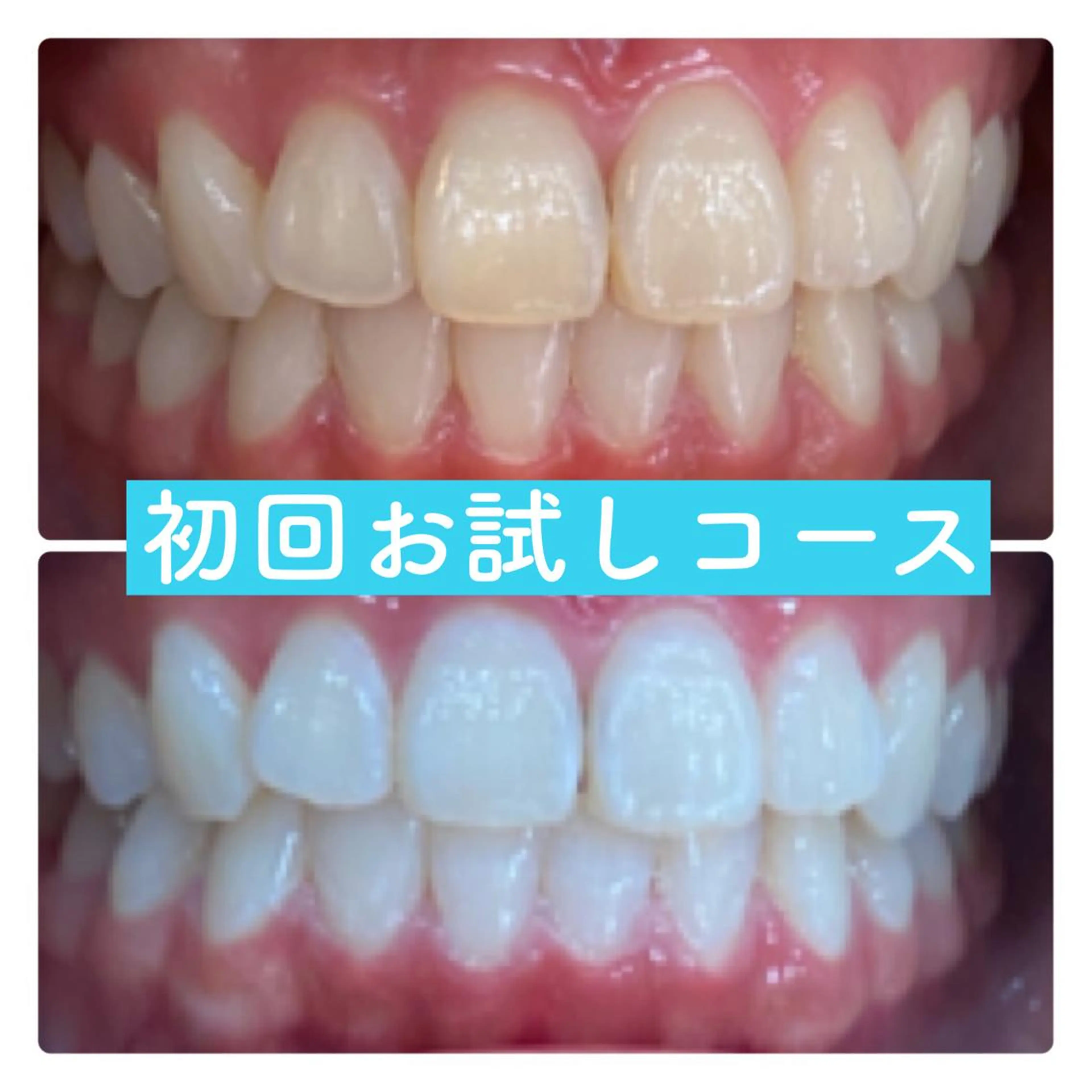 PLATINUM Beauty 横浜店所属・ホワイトニングルーム 横浜店のその他イメージ