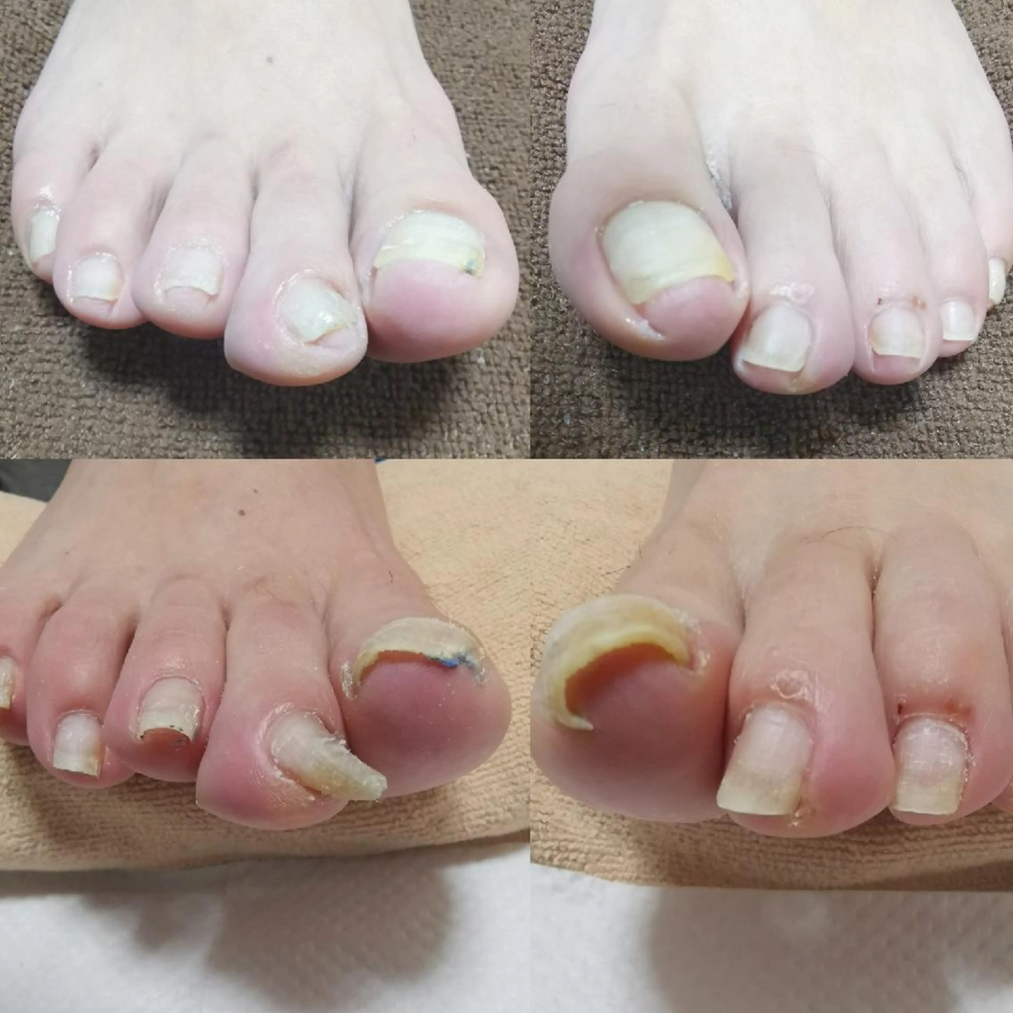 ネイル フットネイル reve あやののネイルデザイン