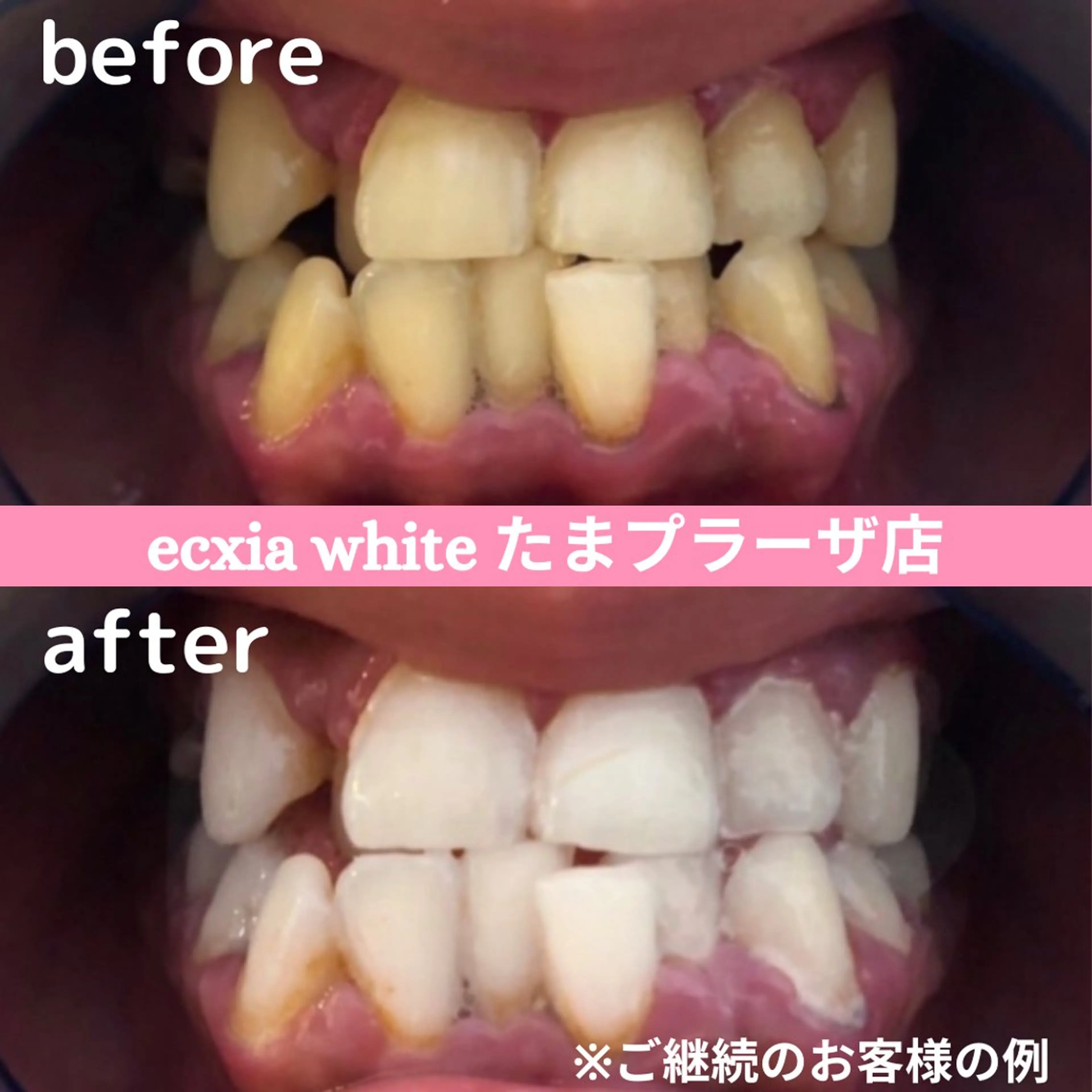 その他 セルフホワイトニング　エクシアたまプラーザ店所属・yukari - オーナー -のその他イメージ