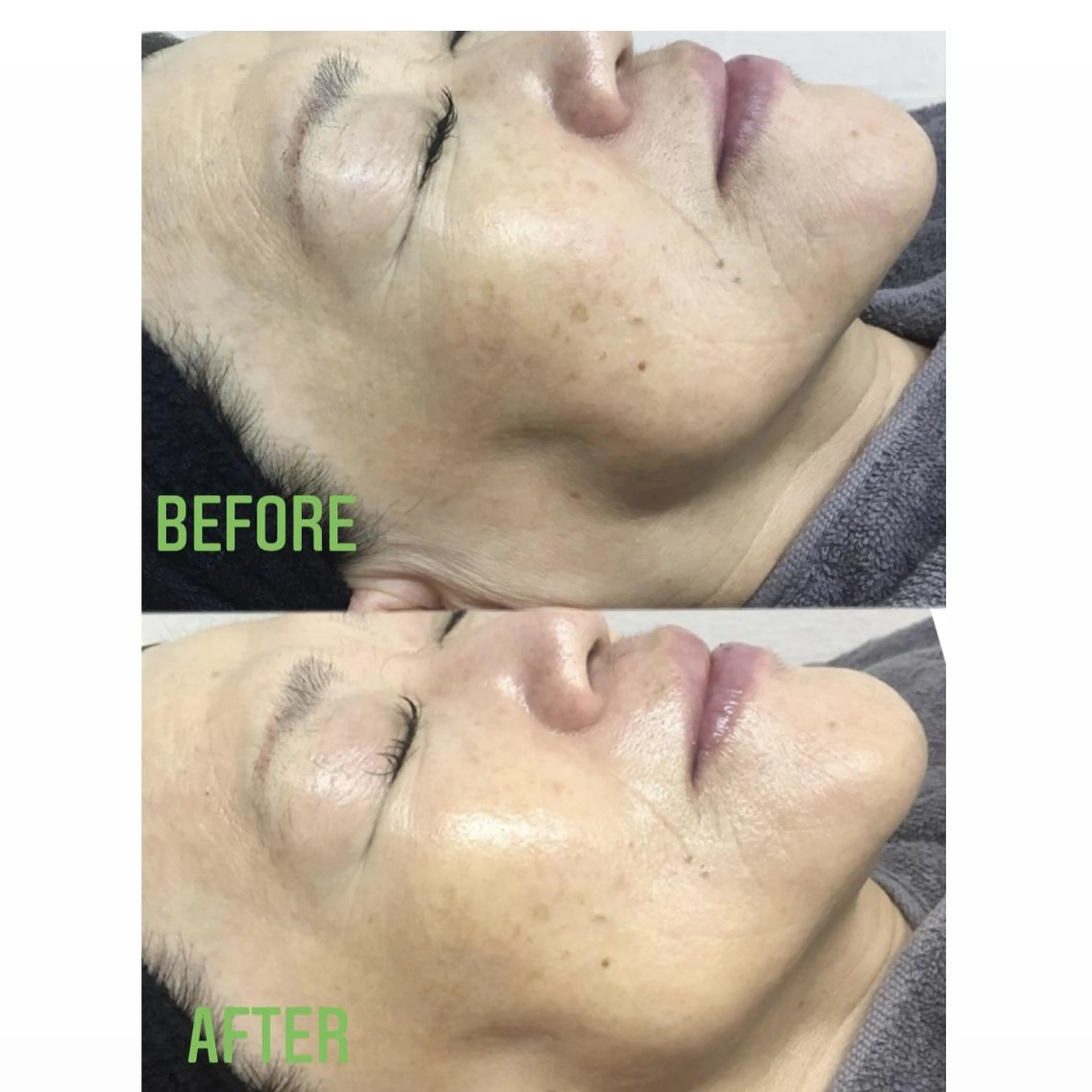 エステ プラティーヌ ボーテのその他イメージ