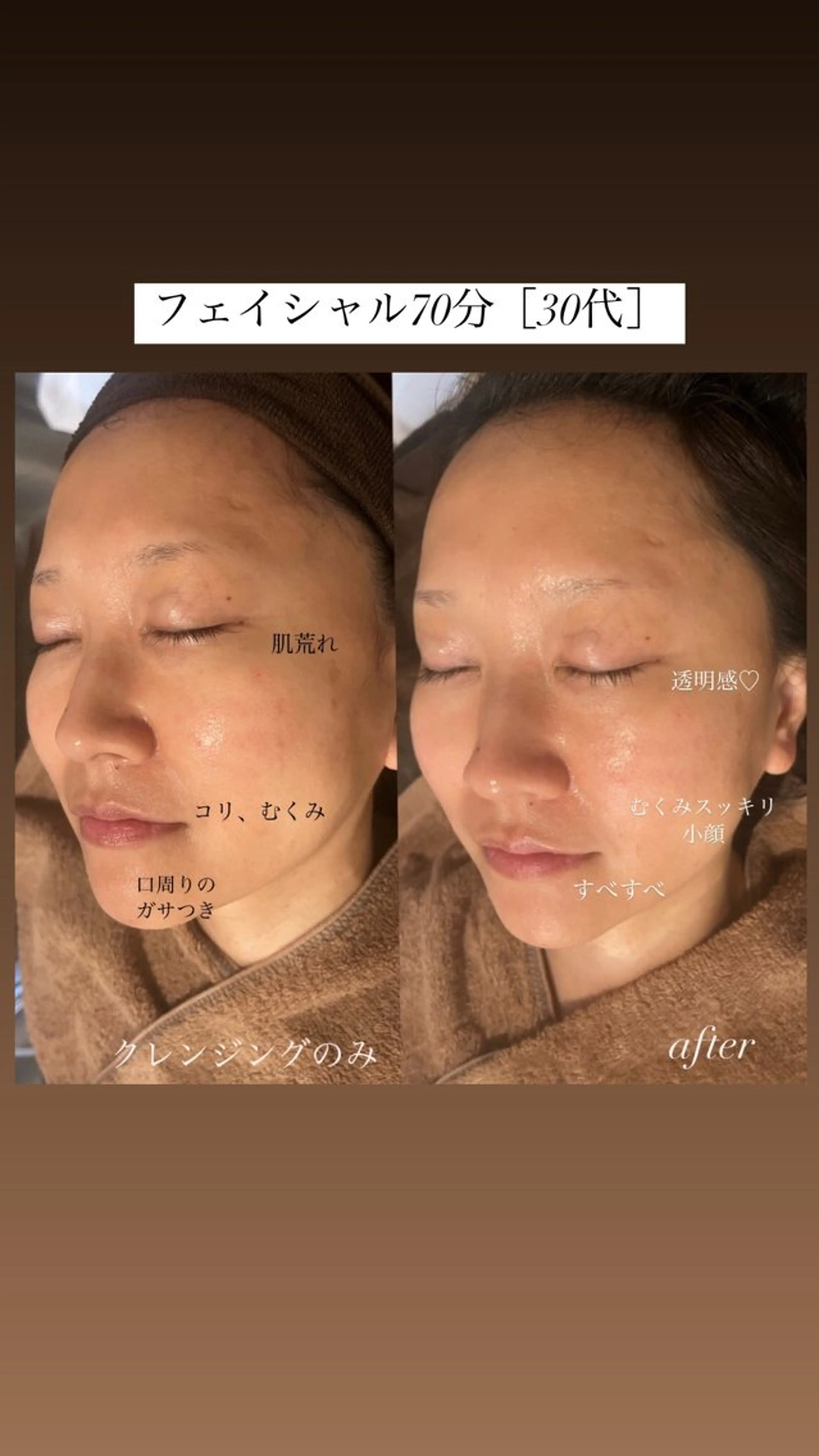 エステ Terra.所属・松村 彩乃のエステ・リラクイメージ