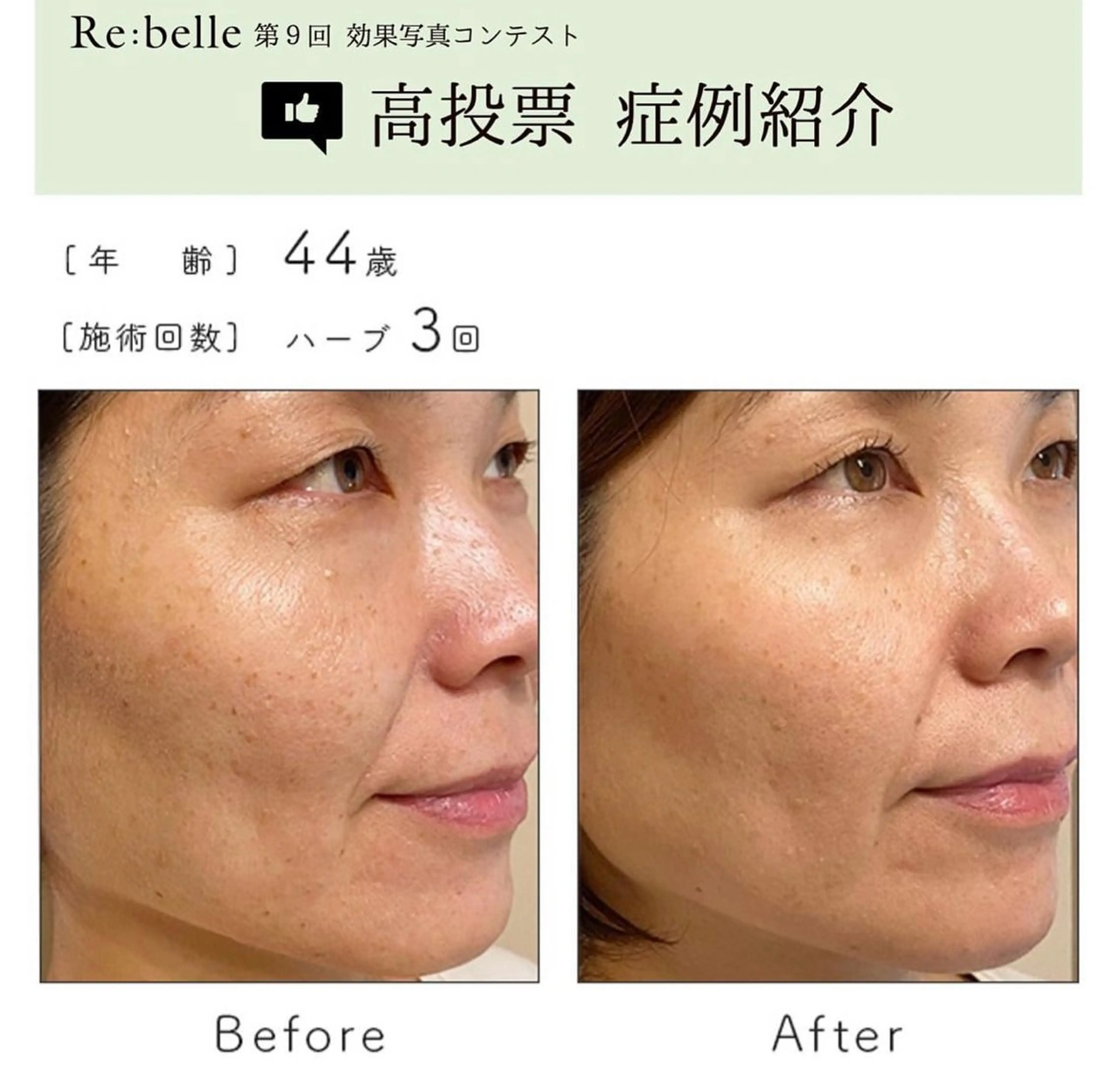 Liberte’/ rinaのマツエク・マツパデザイン