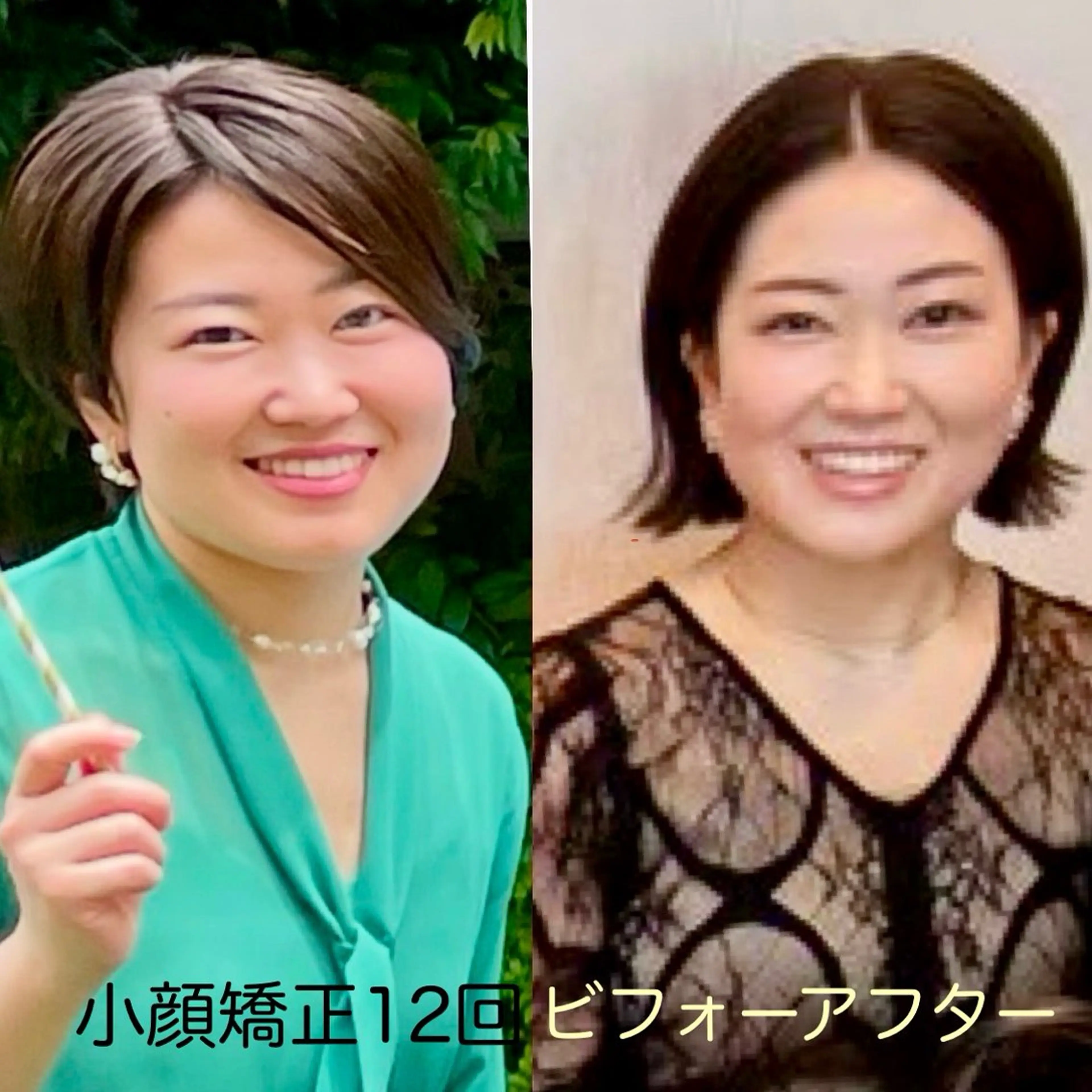 小顔矯正Speed KOGAO渋谷本店のエステ・リラクイメージ