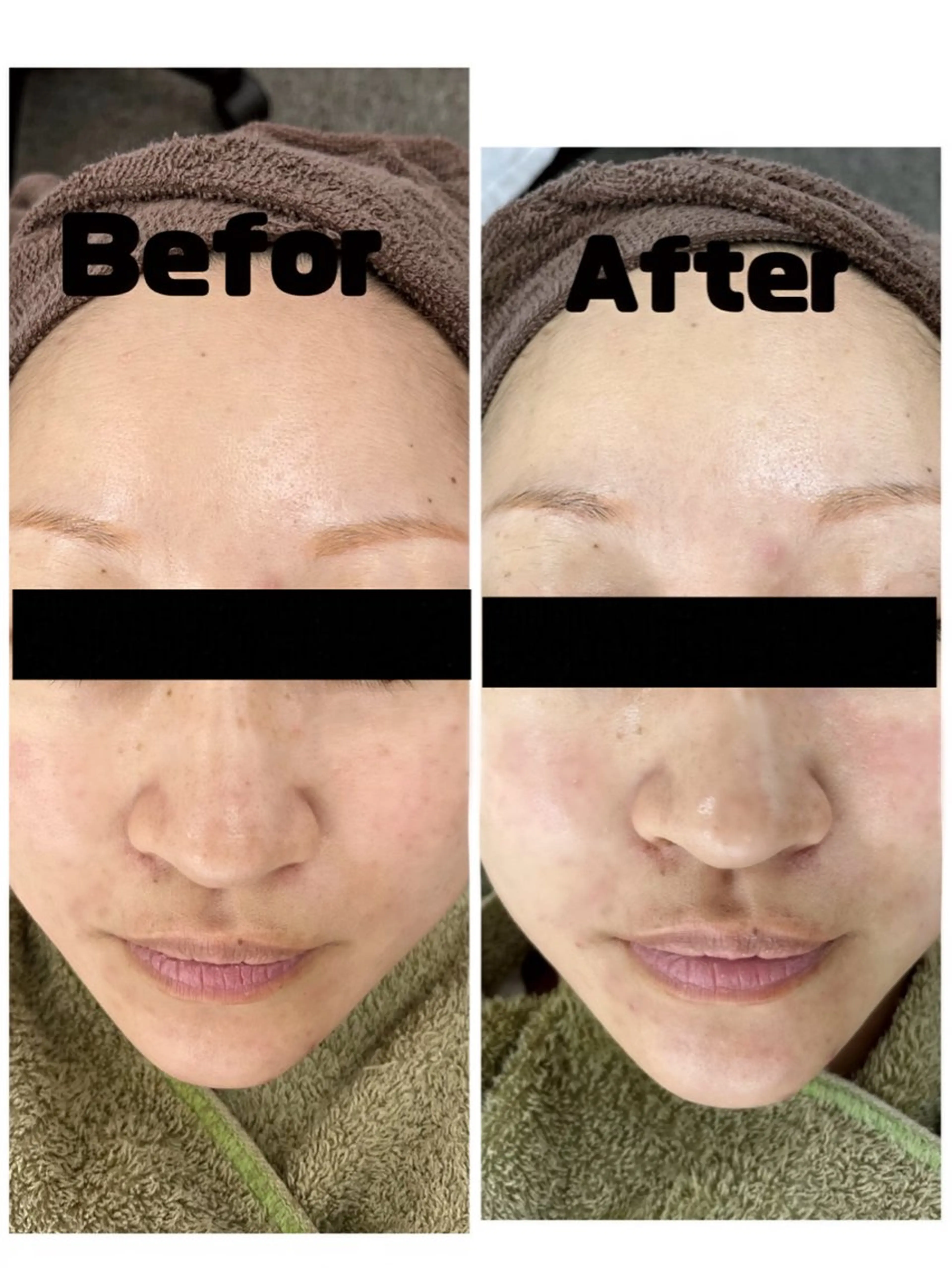 Beauty salon Lakiのエステ・リラクイメージ