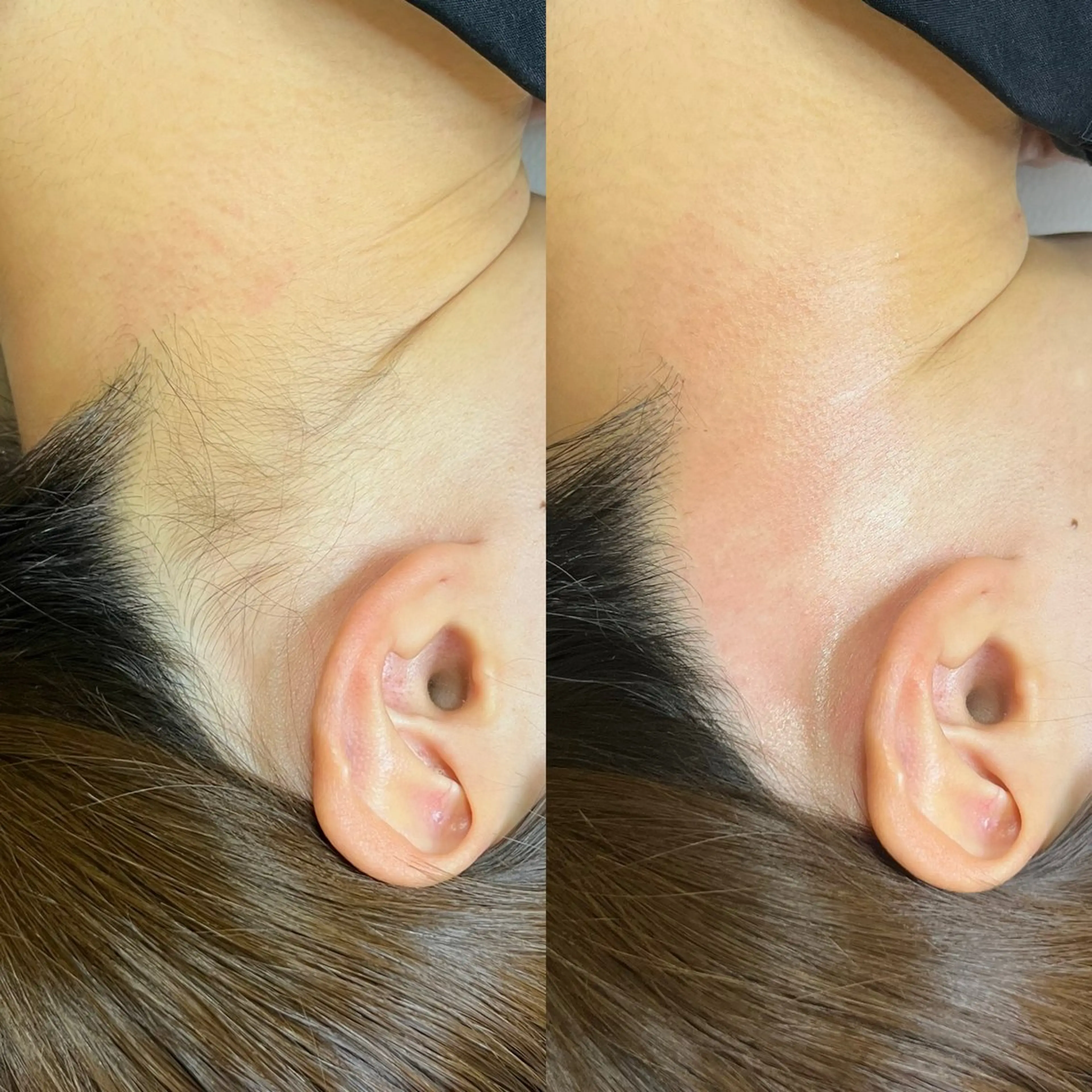 脱毛 Olu所属・ai /Oluの眉毛・アイブロウイメージ