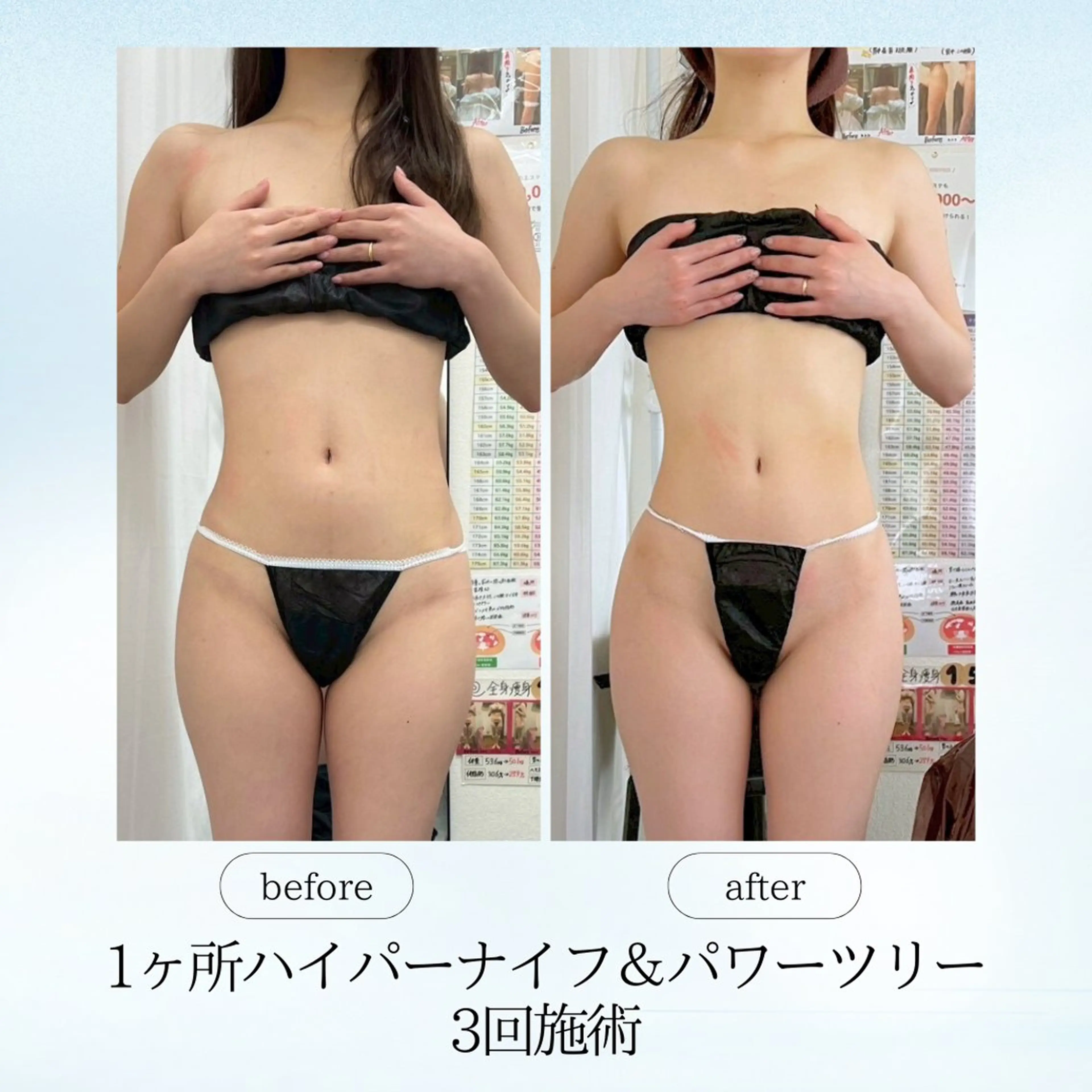 エステ リラク 《痩身、小顔専門店》 エスプレッソのエステ・リラクイメージ