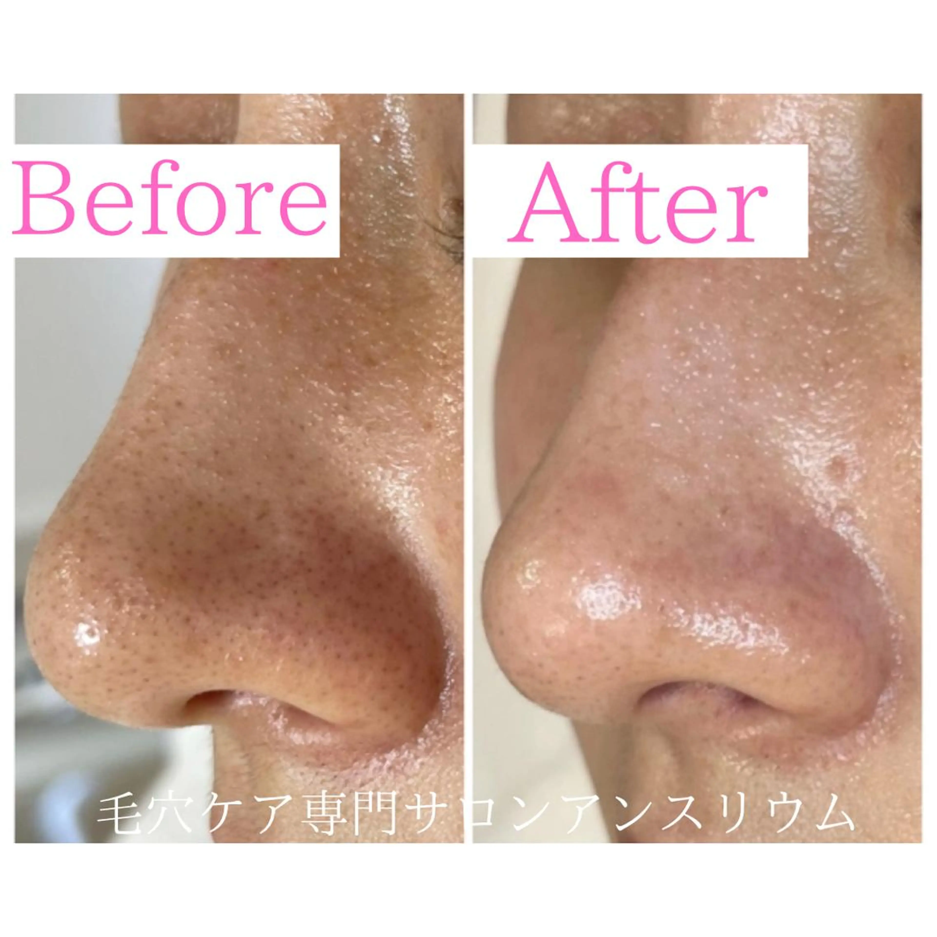 茨城土浦 つくば毛穴 ケア専門サロンのエステ・リラクイメージ