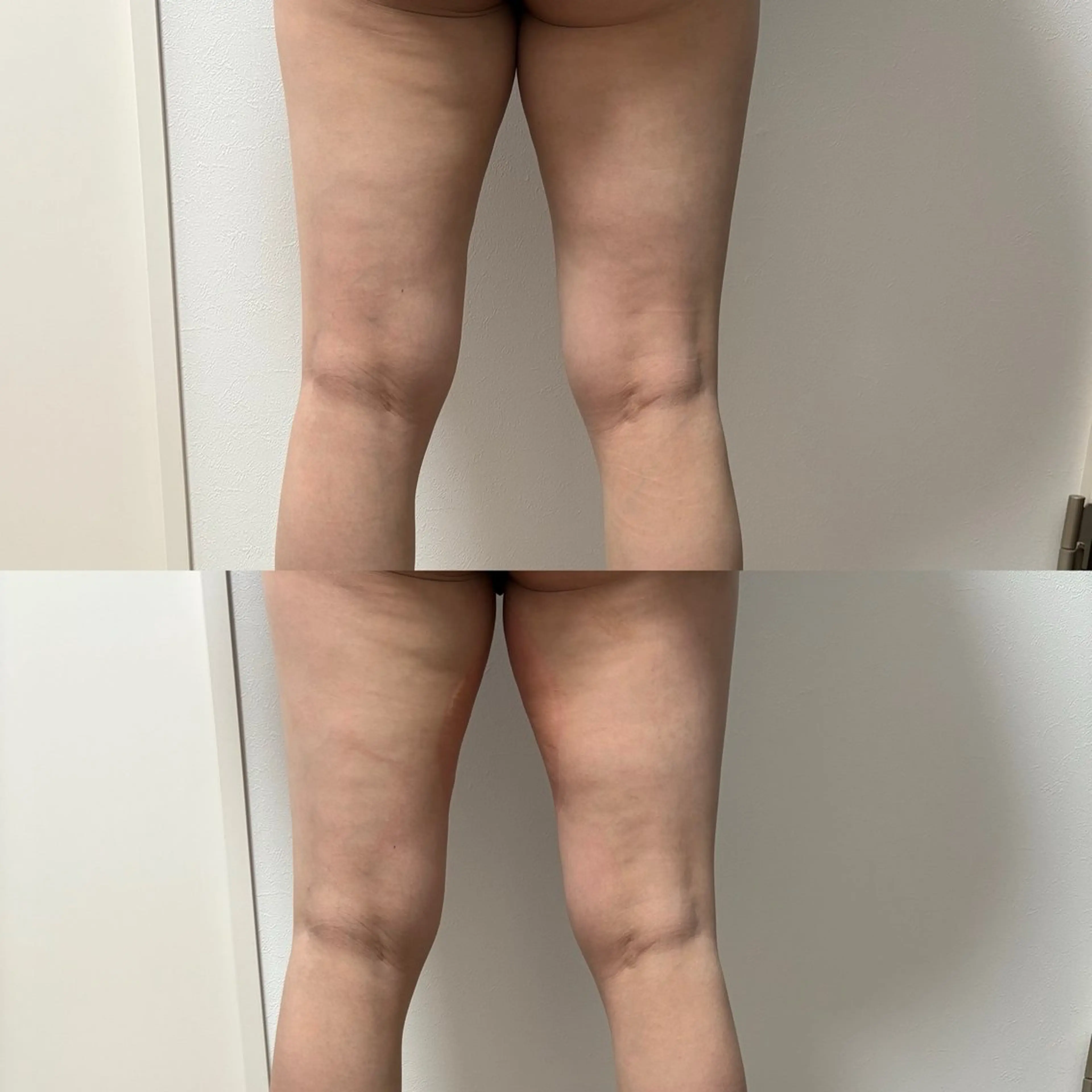 エステ Miiju.所属・石巻 冷却痩身 Miiju. 鈴木のエステ・リラクイメージ